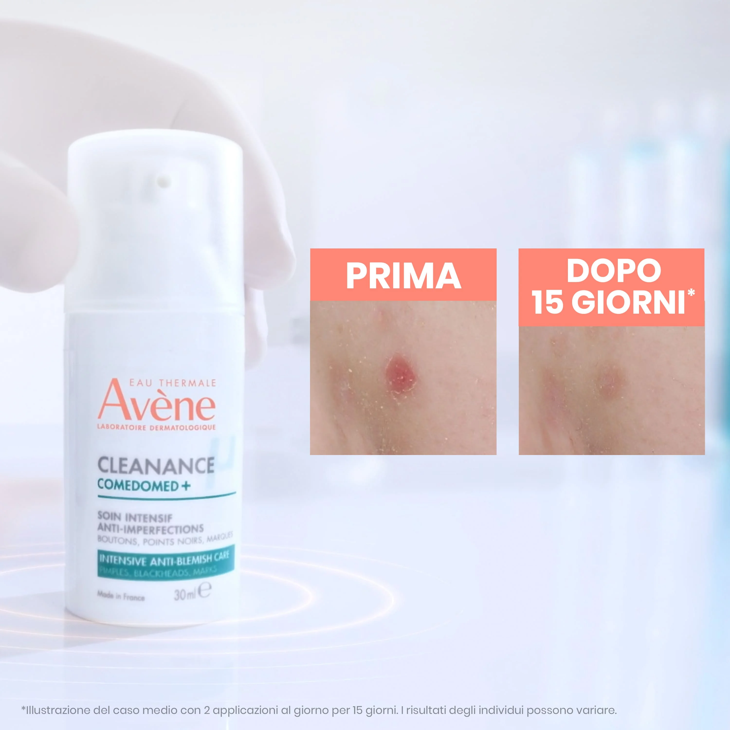 Avene Cleanance Comedomed+ Anti Imperfezioni 30 Ml Brufoli e Punti Neri