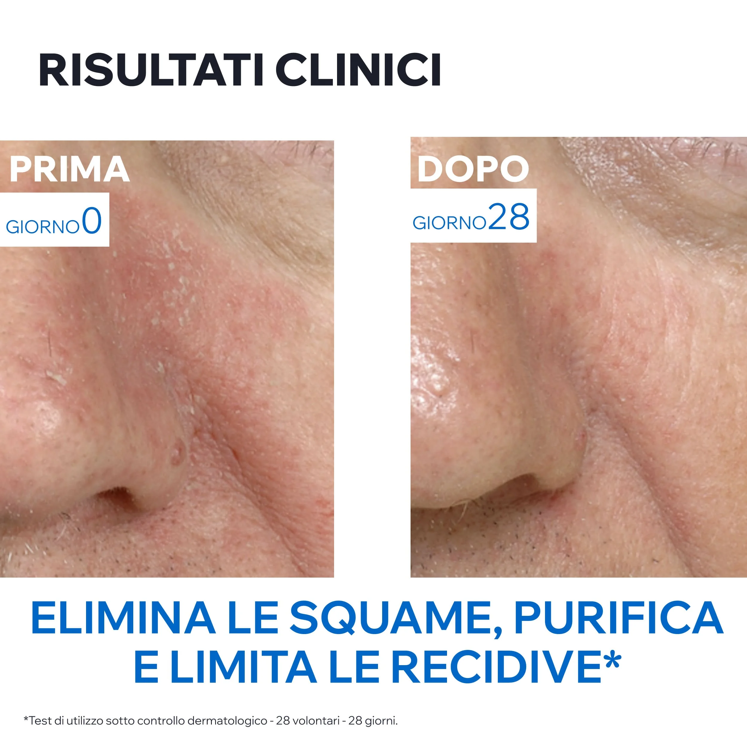 Uriage DS Emulsione Trattamento Regolatore Pelle Irritata 40 ml Idratazione Profonda