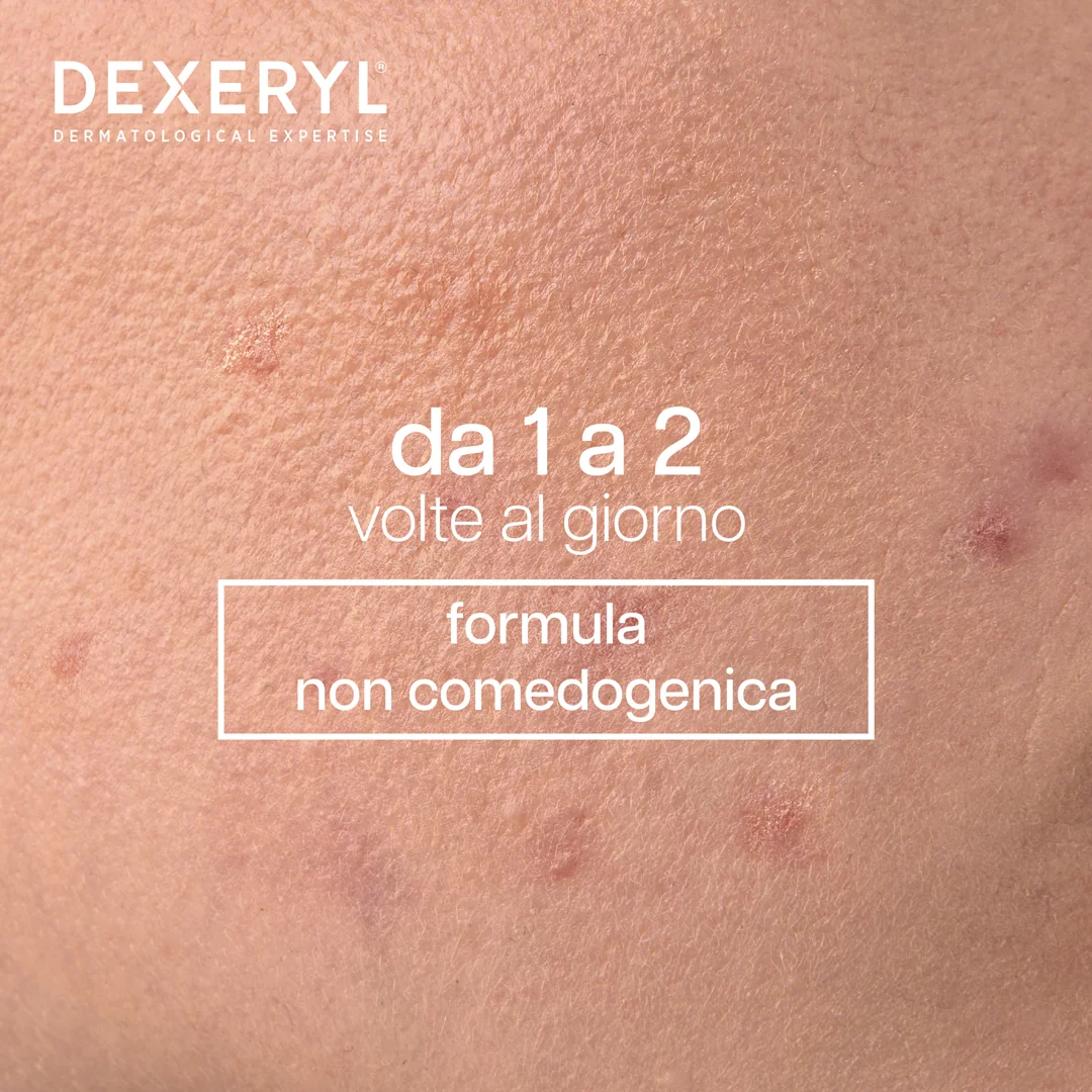 Dexeclear Detergente Idratante Lenitivo 200 Ml