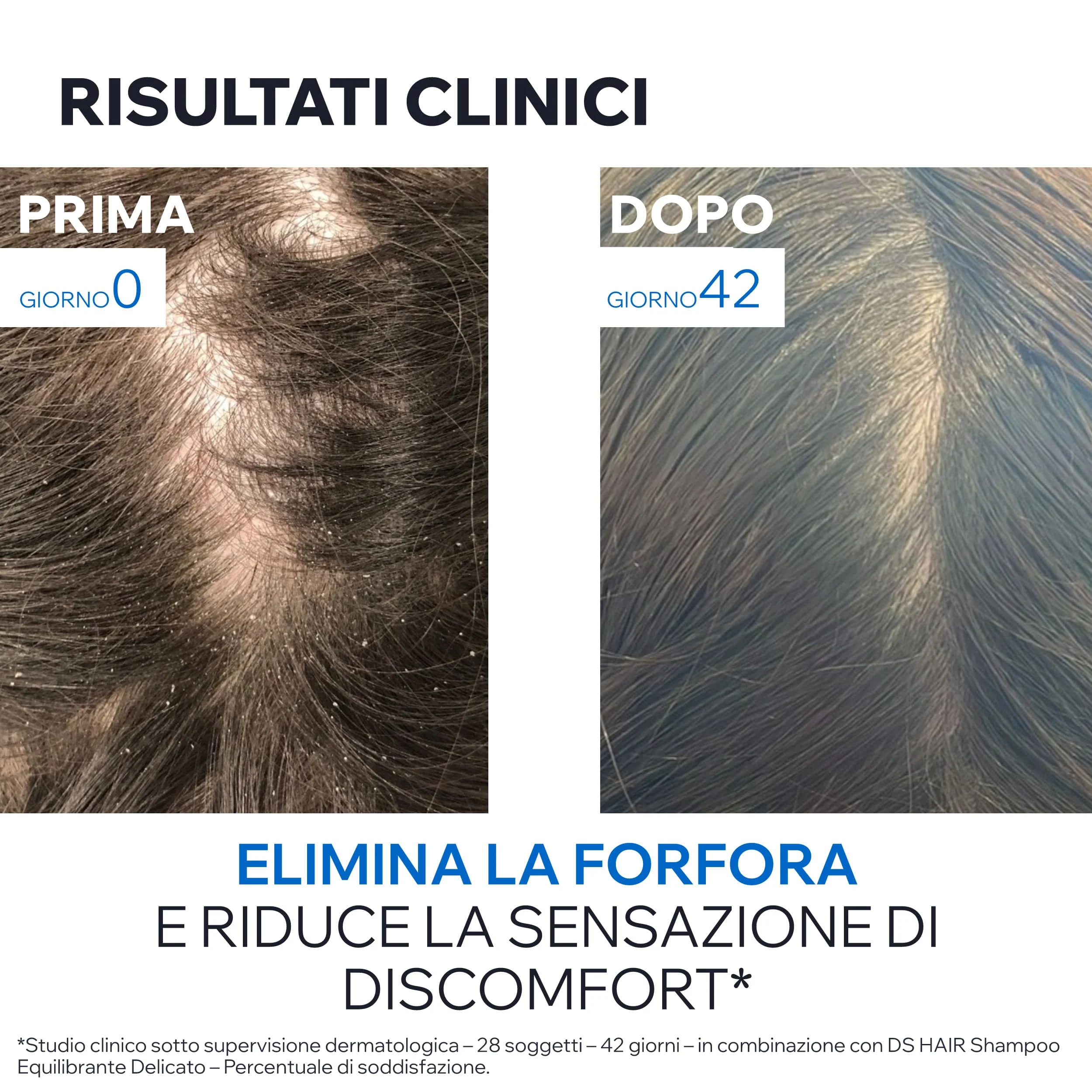 Uriage Ds Hair Sh Traitant Antipelliculaire Lenisce il Prurito