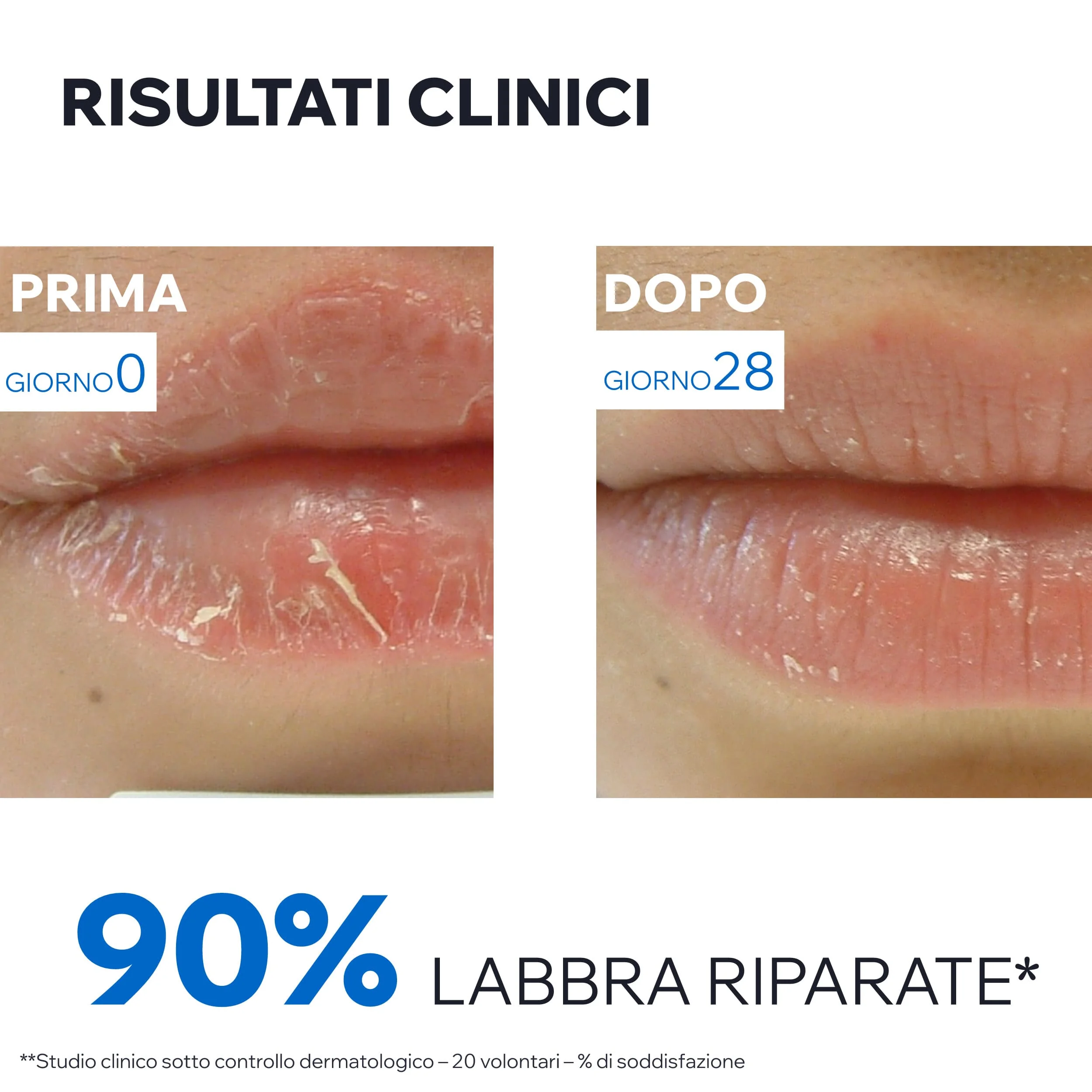 Uriage Barièderm Cica-Levres Balsamo Labbra Secche Screpolate 15 ml Balsamo Barriera