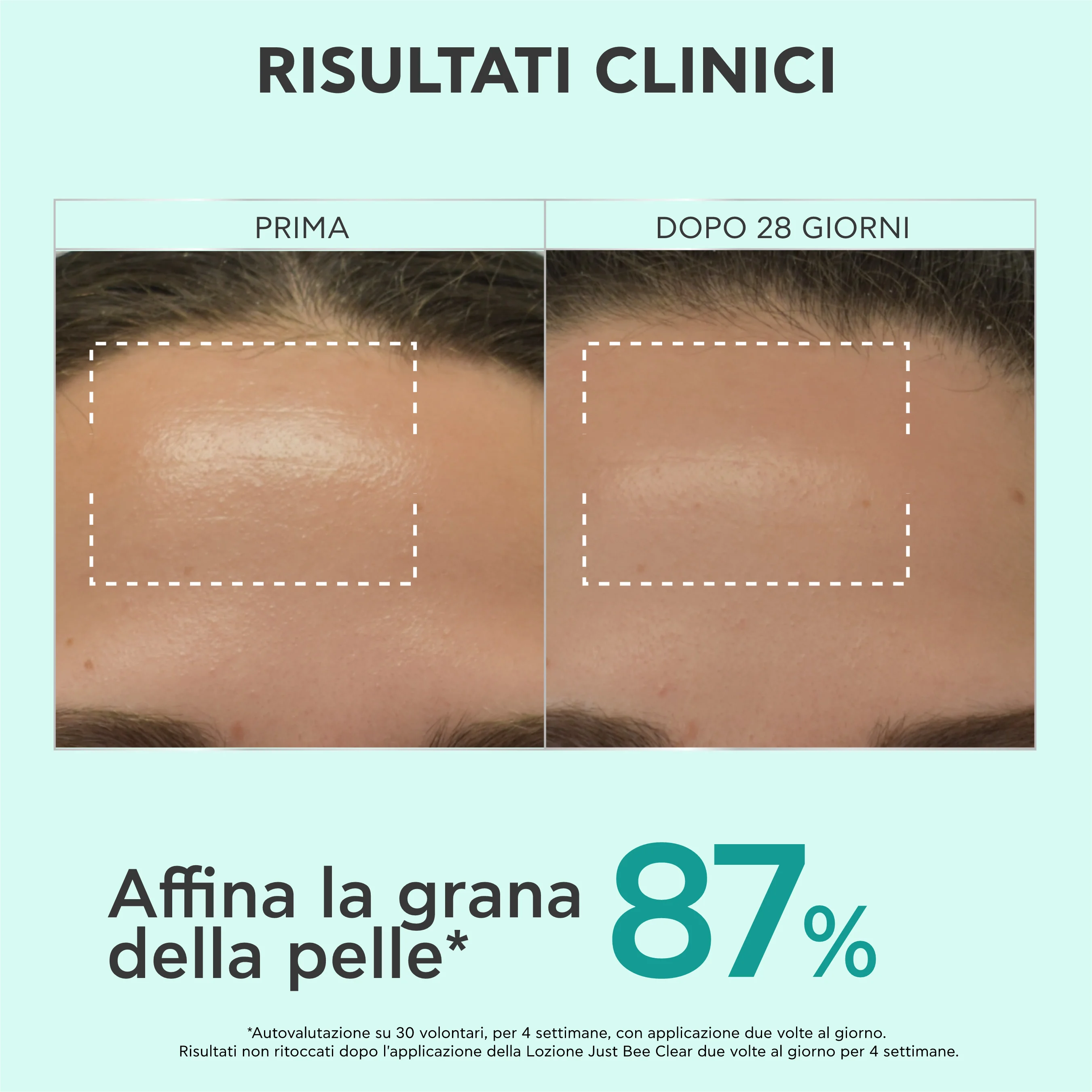 Apivita Just Bee Clear Lotion 200 ml Lozione Purificante