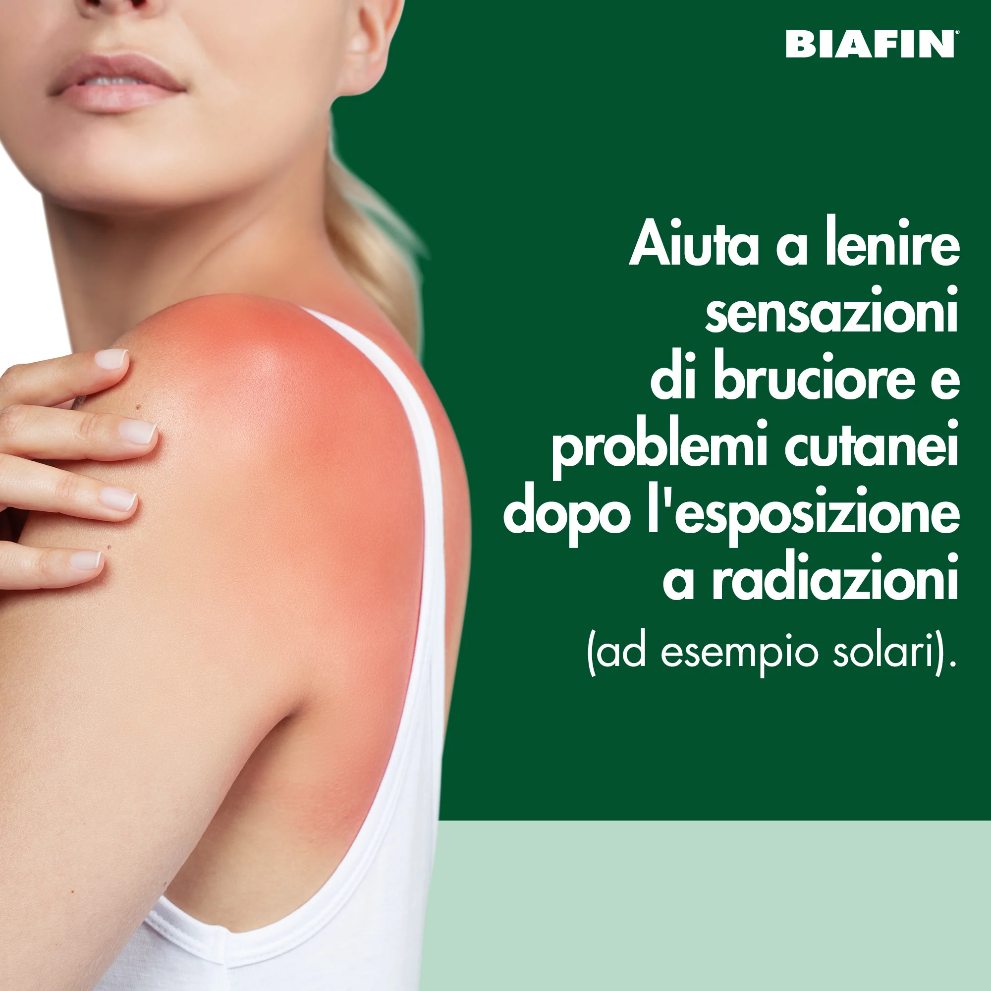 Biafin Emulsione Cutanea Idratante Lenitiva 100 ml Crema Scottature e Pelle Sensibile e Irritata