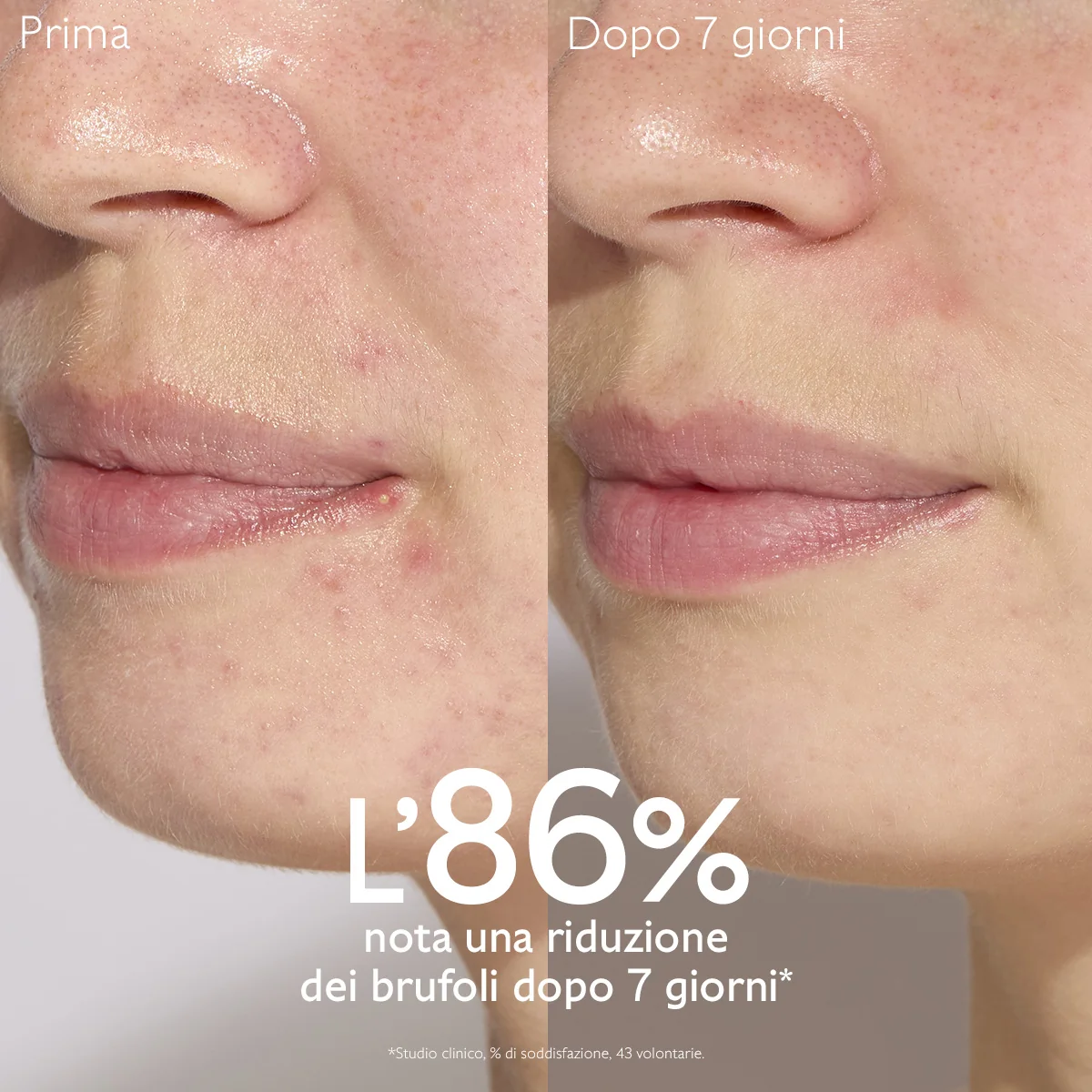 Vinopure Siero Anti Imperfezioni 30 Ml