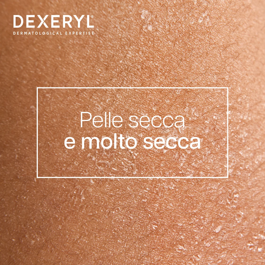 Dexeryl Latte Nutritivo 200 ml per Pelle Secca
