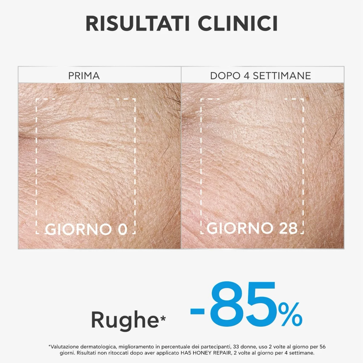 Apivita Bee Tech Concentrates HA5 Honey Repair 30 Ml Siero Viso Idratante e Anti-Rughe