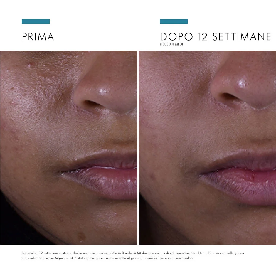SkinCeuticals Silymarin CF Siero 30 Ml Antiossidante con Vitamina C