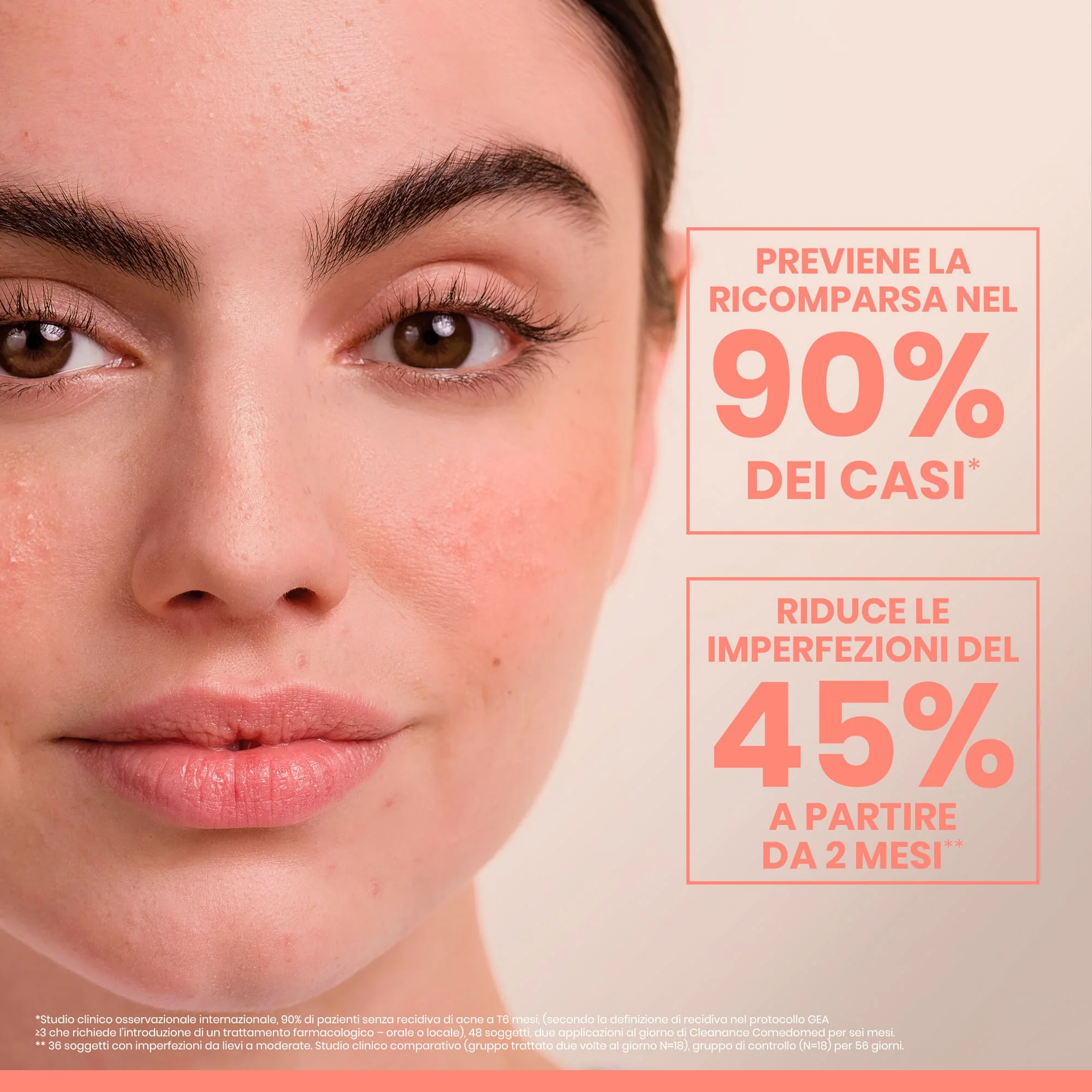 Eau Thermale Avène Cleanance Comedomed Concentrato Anti-imperfezioni 30 ml Pelle Grassa a Tendenza Acneica