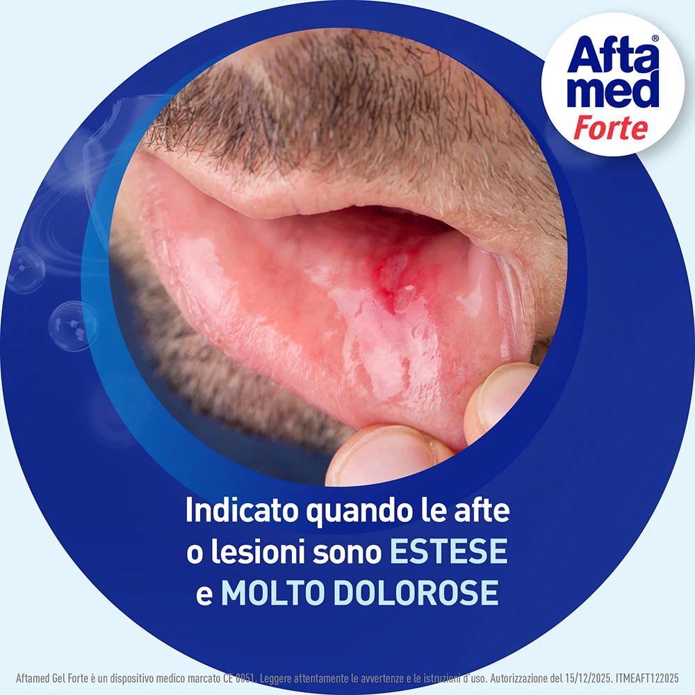 Aftamed Forte Gel Anti-Afte 8 ml Prevenzione Afte