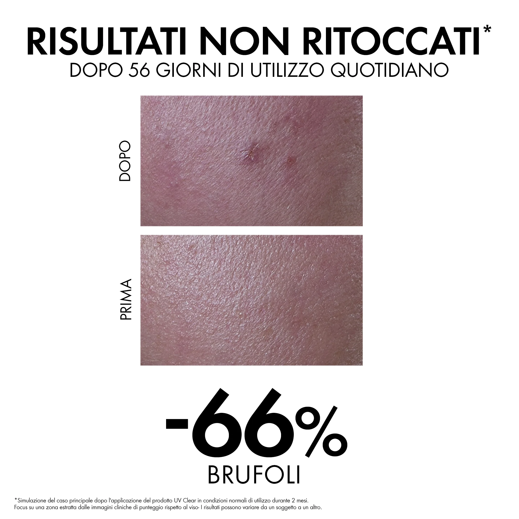 Vichy Capital Soleil UV Clear SPF50 40 Ml Fluido solare antimperfezioni