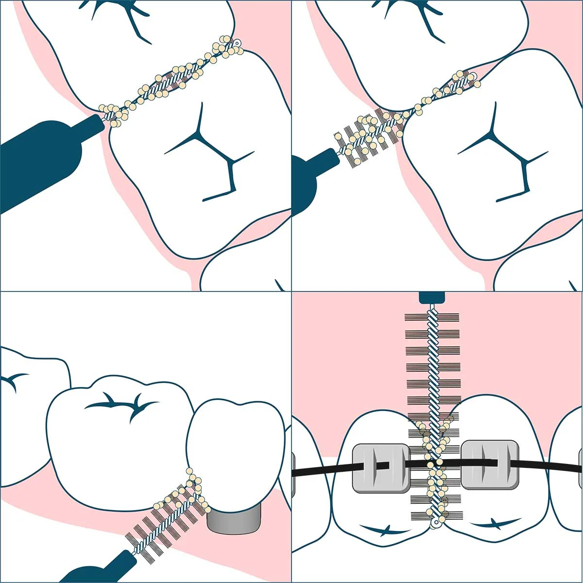 Geldis Doctor Pick Scovolino Xxs 7 Pezzi Cura denti e cavo orale
