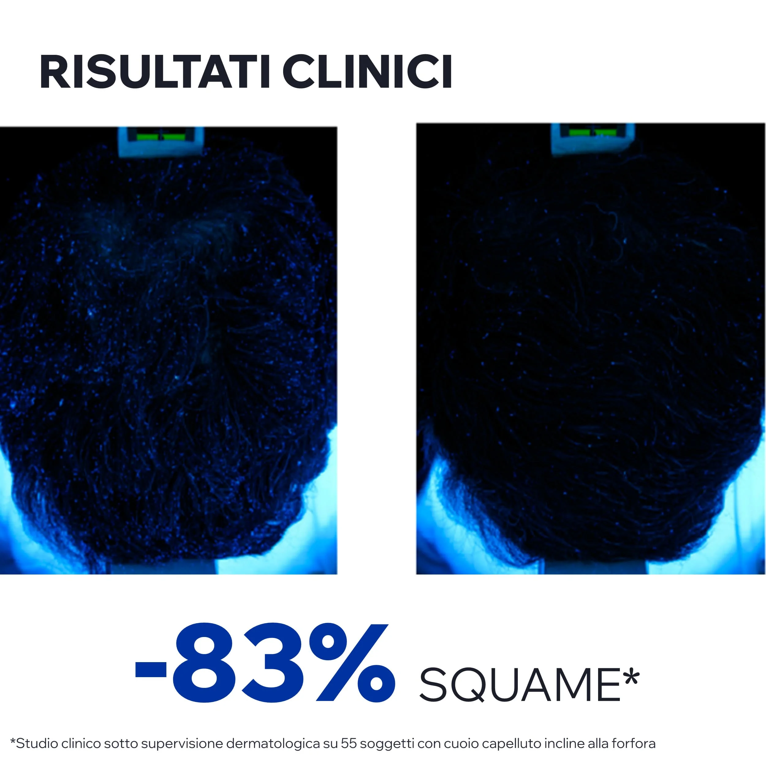 Uriage DS Hair Lozione Spray Lenitivo Regolatore 100 ml Pelle Sensibile Pelle Irritata