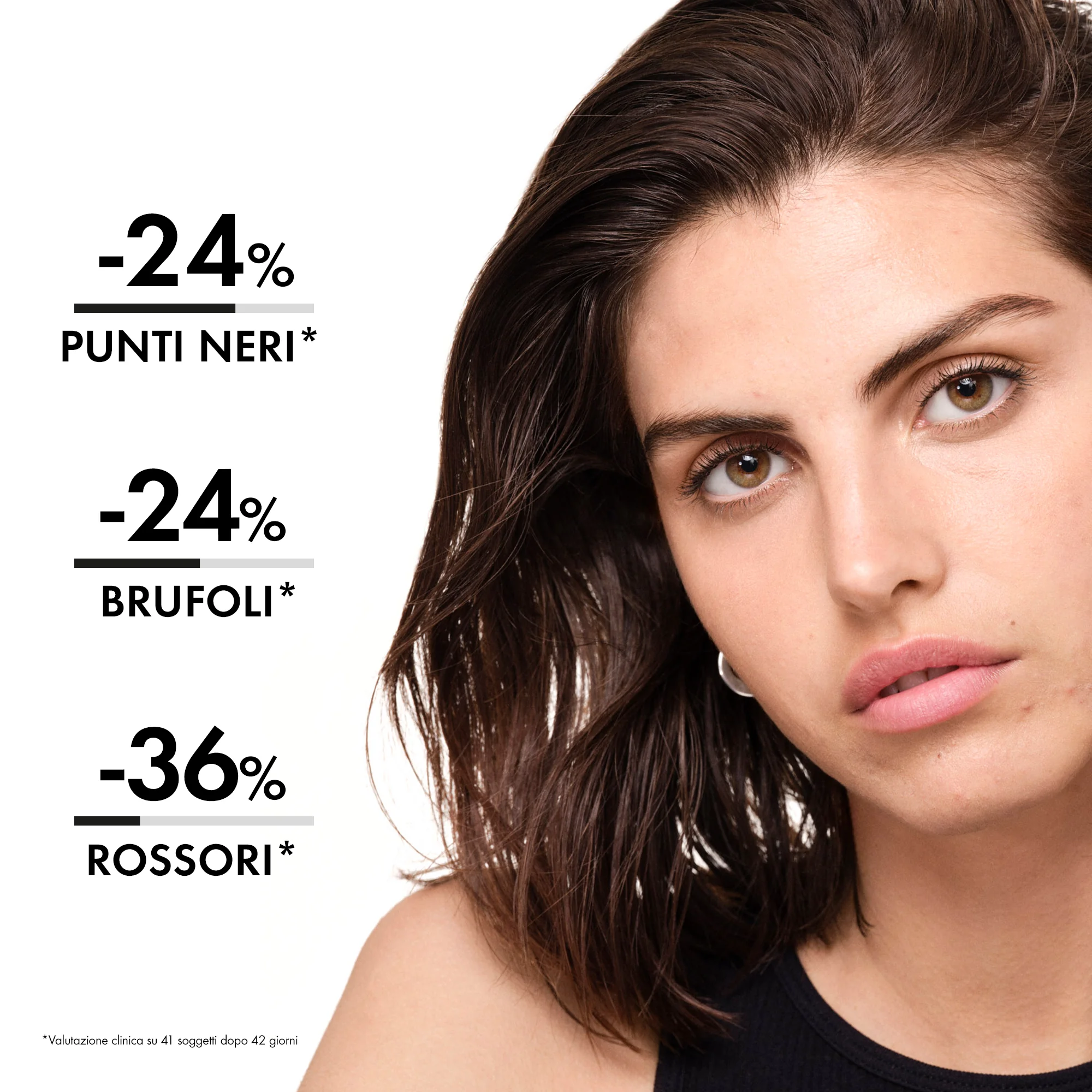 Vichy Normaderm Probio-BHA Siero 30 Ml Anti-Imperfezioni