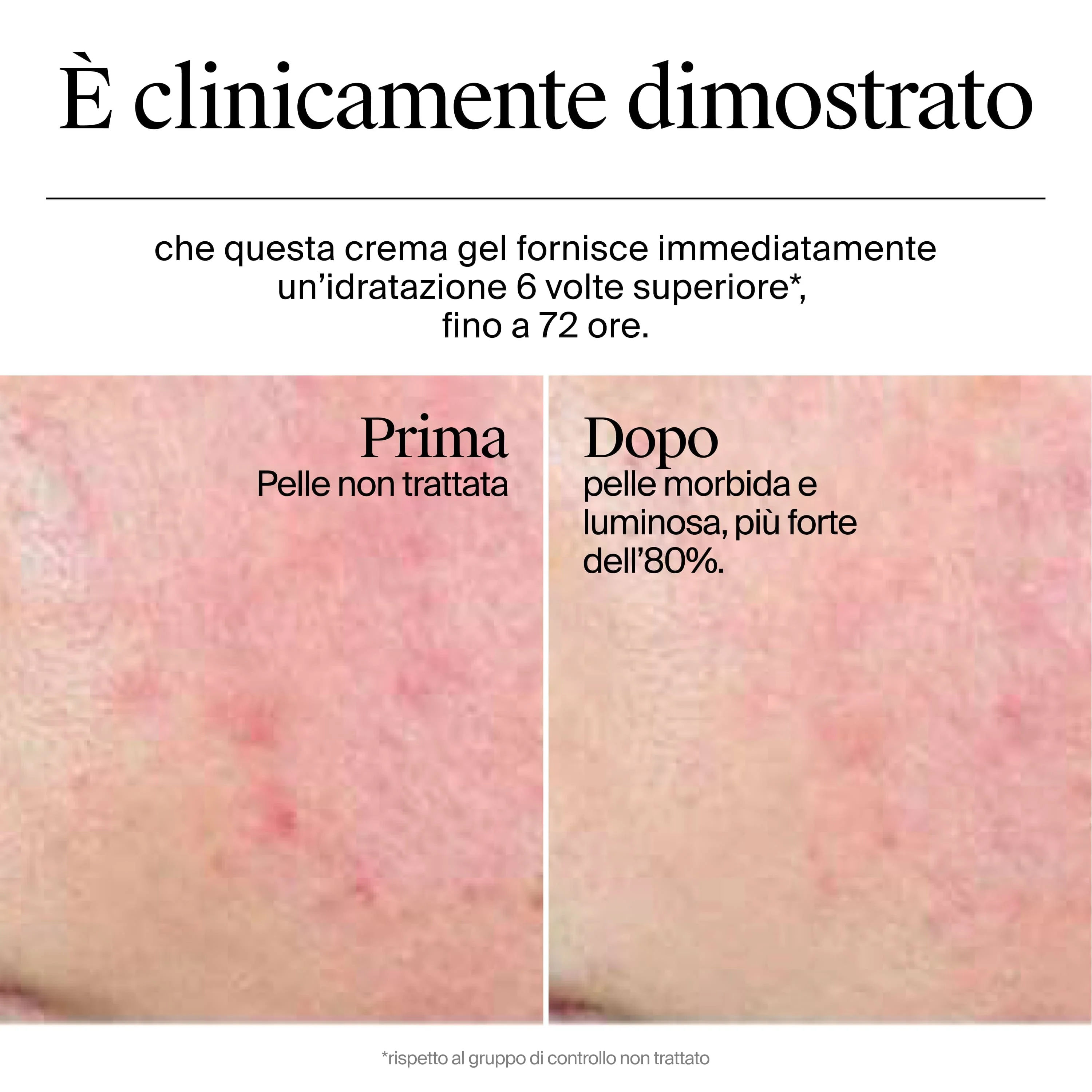 Neutrogena Hydro Boost Crema Gel 50 ml Crema Idratante Viso con Acido Ialuronico per Pelle Secca