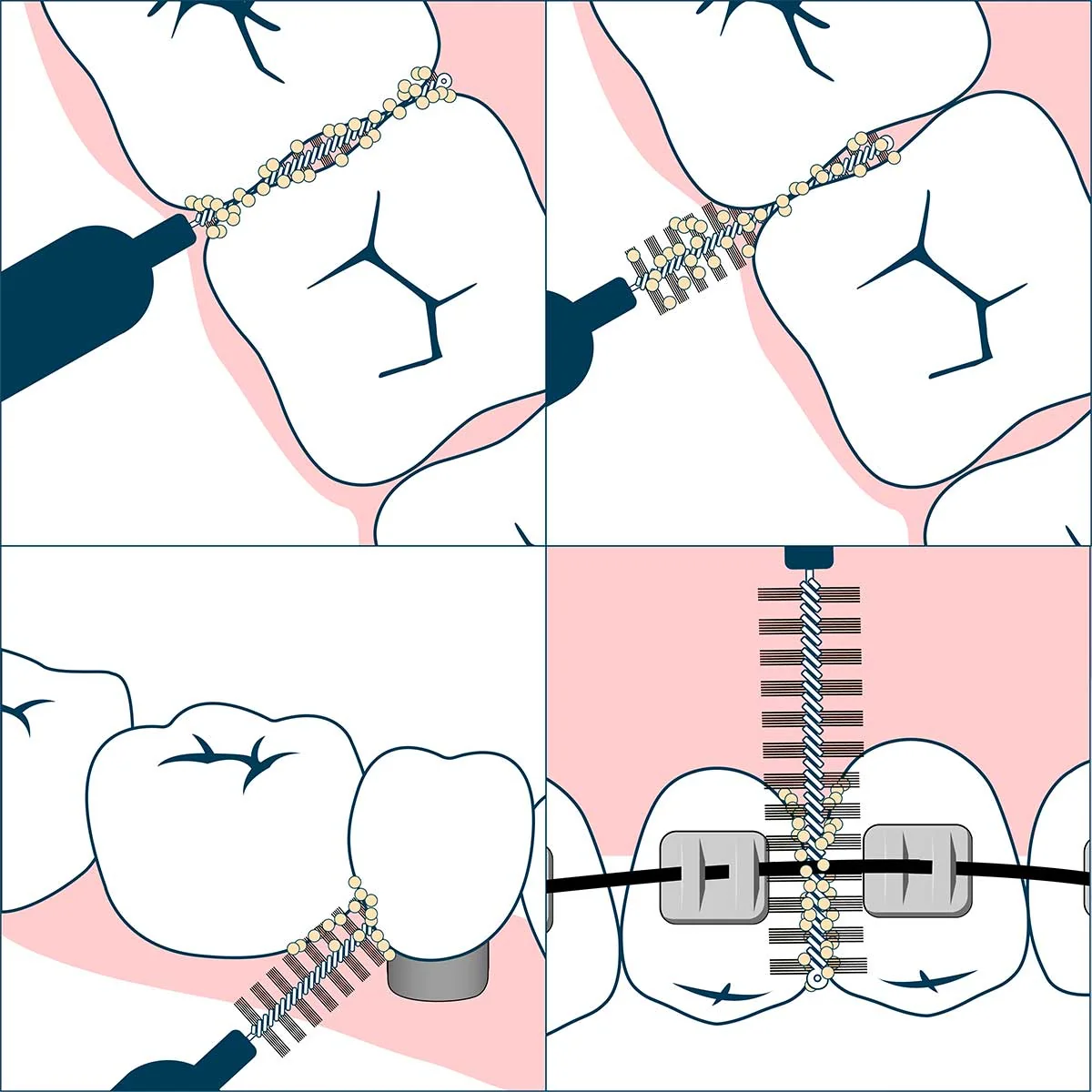 Geldis Doctor Pick Scovolino S 7 Pezzi Cura denti e cavo orale
