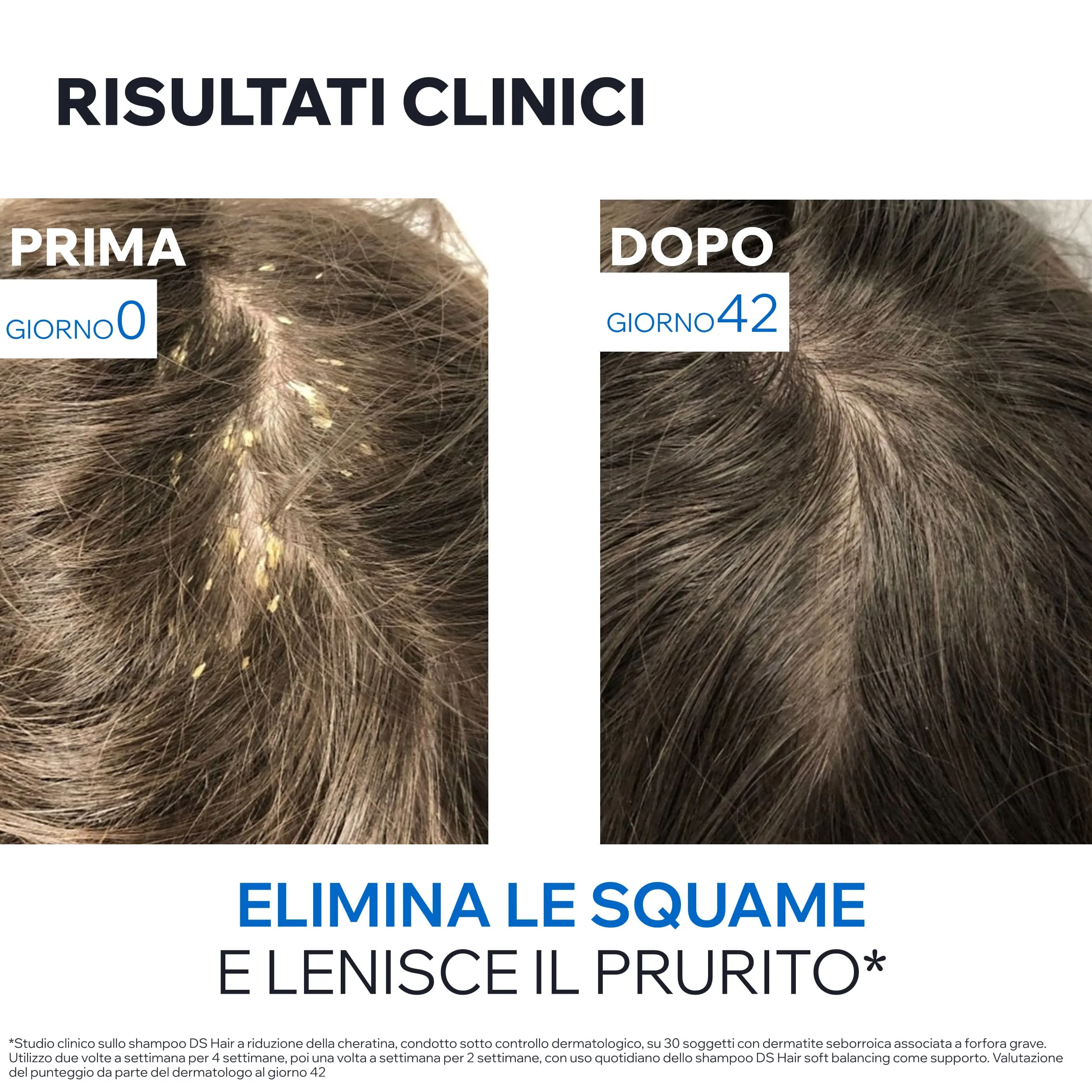 Uriage Ds Hair Sh Cheratoridut Esfoliazione Delicata