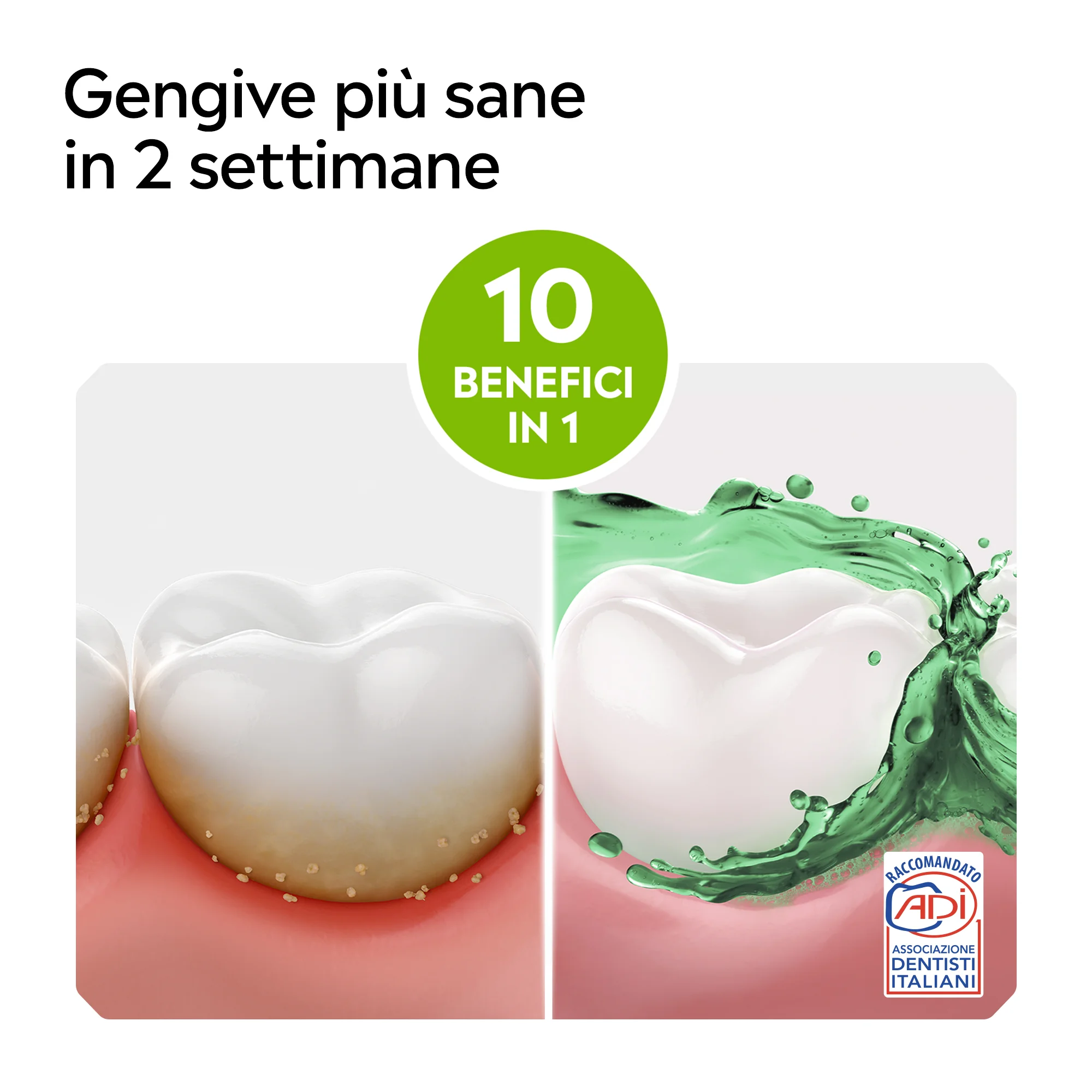 Listerine Difesa Denti e Gengive Collutorio 500 ml Menta delicata