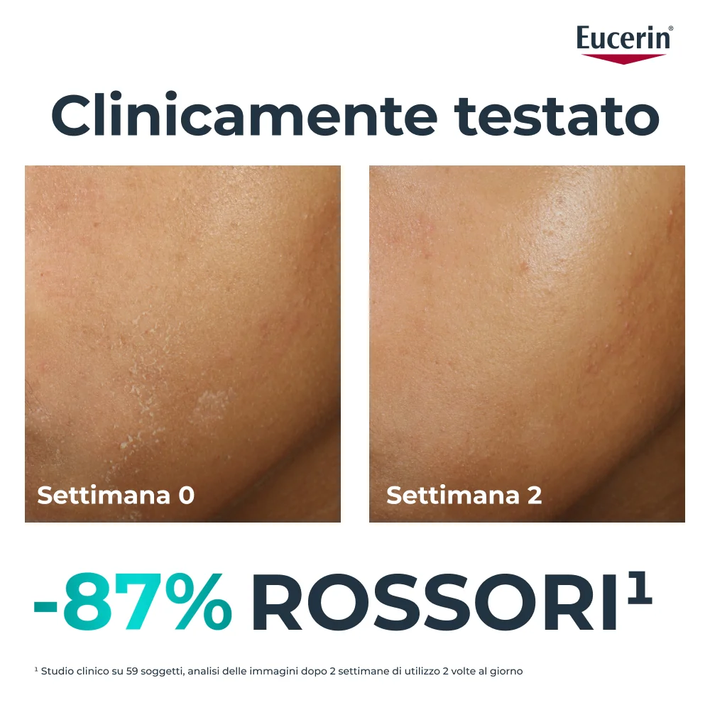 Dermopure Clinical Hydra Repair Trattamento Lenitivo 50Ml Pelle Grassa a Tendenza Acneica