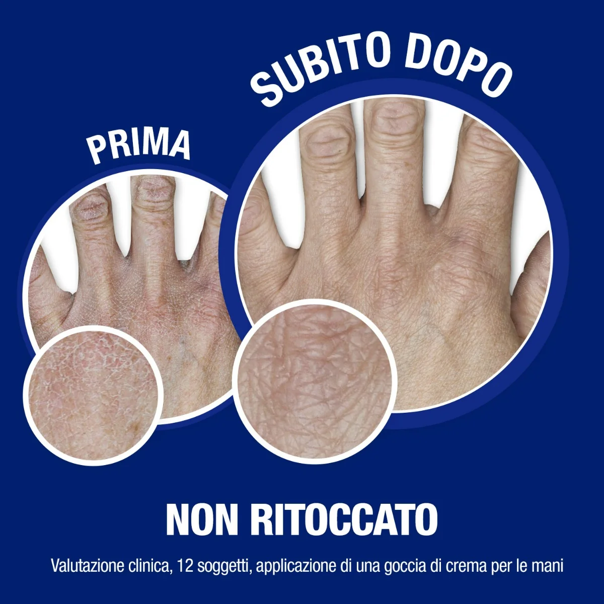 Neutrogena Formula Norvegese Crema Mani e Unghie 75 ml Idrata Intensamente