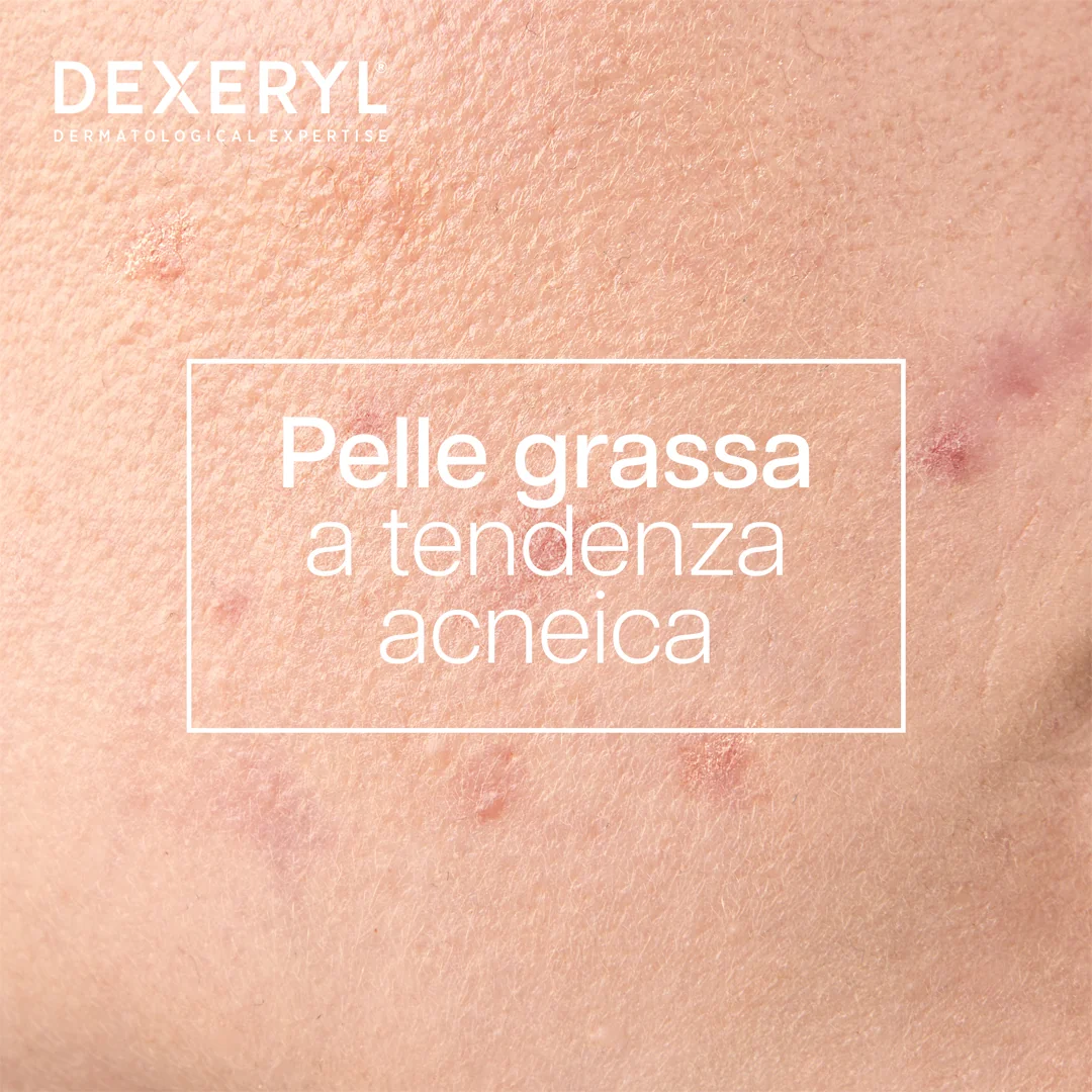 Dexeclear Gel Schiumogeno Anti Imperfezioni 200 Ml Detersione pelle acneica