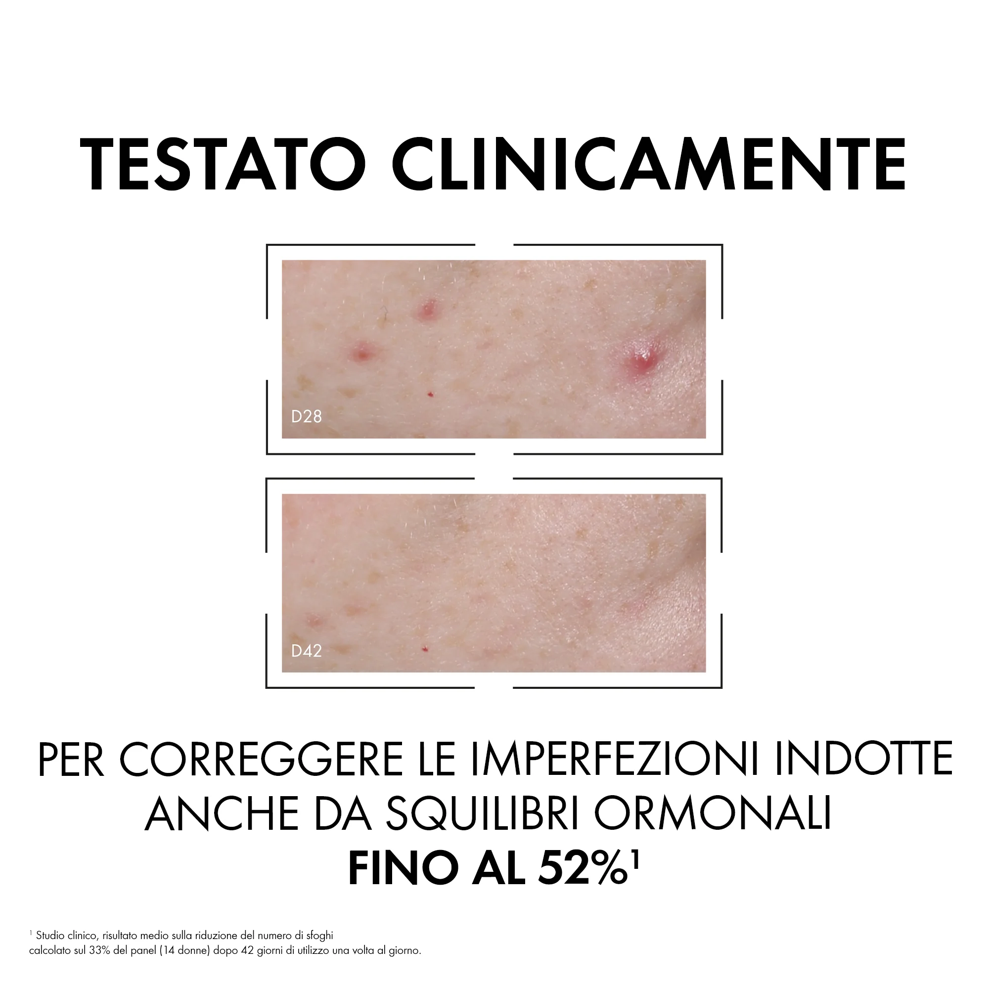 Vichy Normaderm Probio-BHA Siero 30 Ml Anti-Imperfezioni