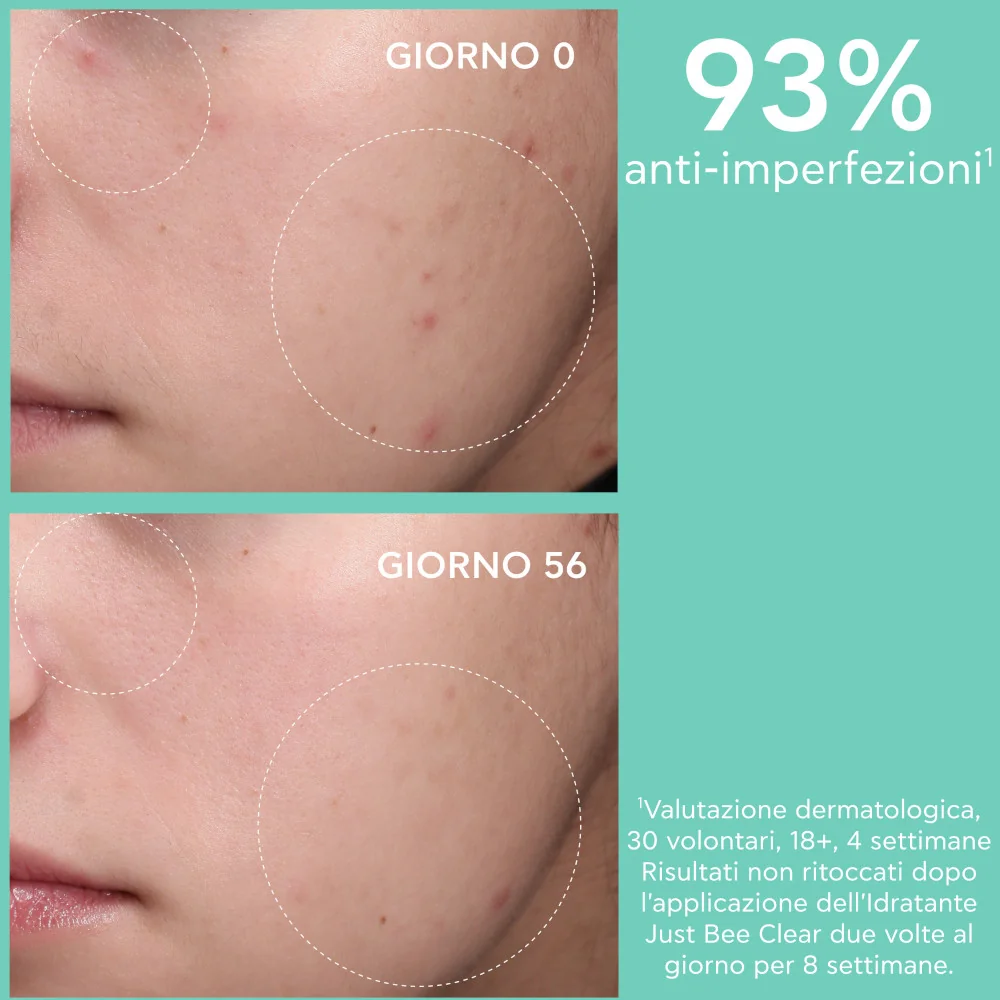 Apivita Just Bee Clear Hydra 40 ml Crema Idratante Opacizzante