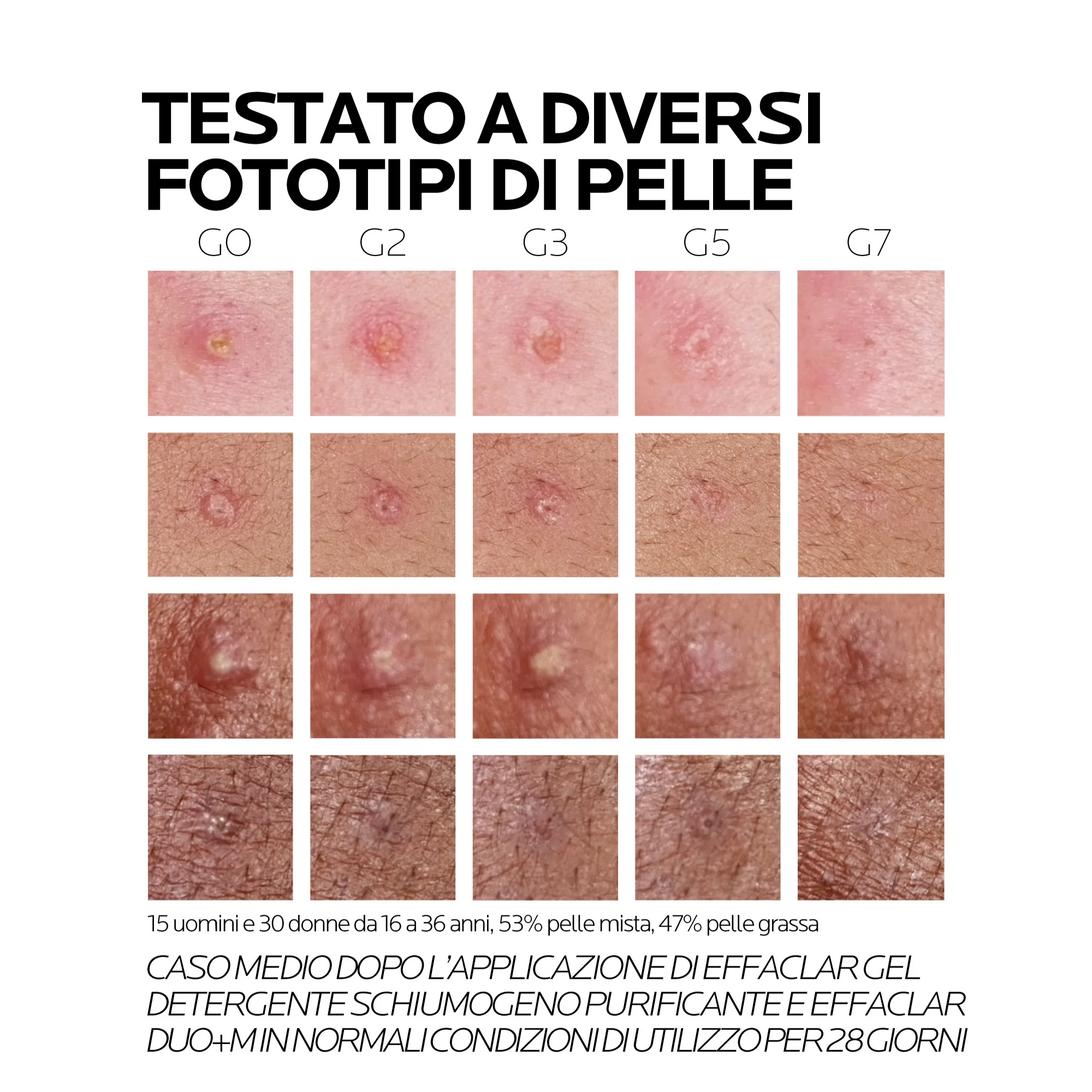La Roche Posay Effaclar Duo(+) Crema 40 Ml Trattamento Imperfezioni