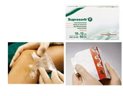 Suprasorb F 5X7 cm 10Pz