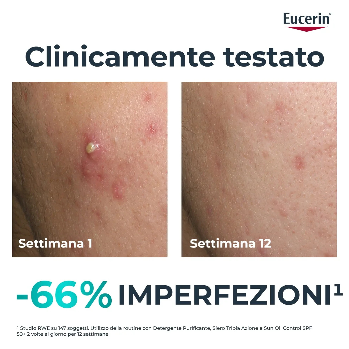 Dermopure Clinical Siero Tripla Azione 40Ml Pelle Grassa a Tendenza Acneica