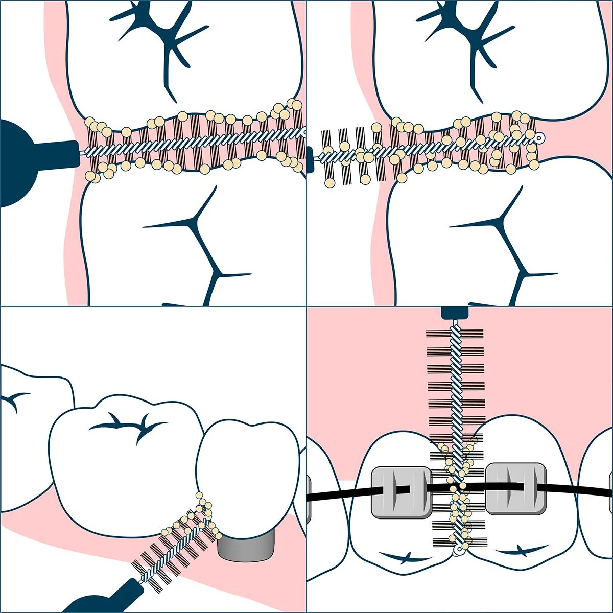 Geldis Doctor Pick Scovolino M 7 Pezzi Cura denti e cavo orale