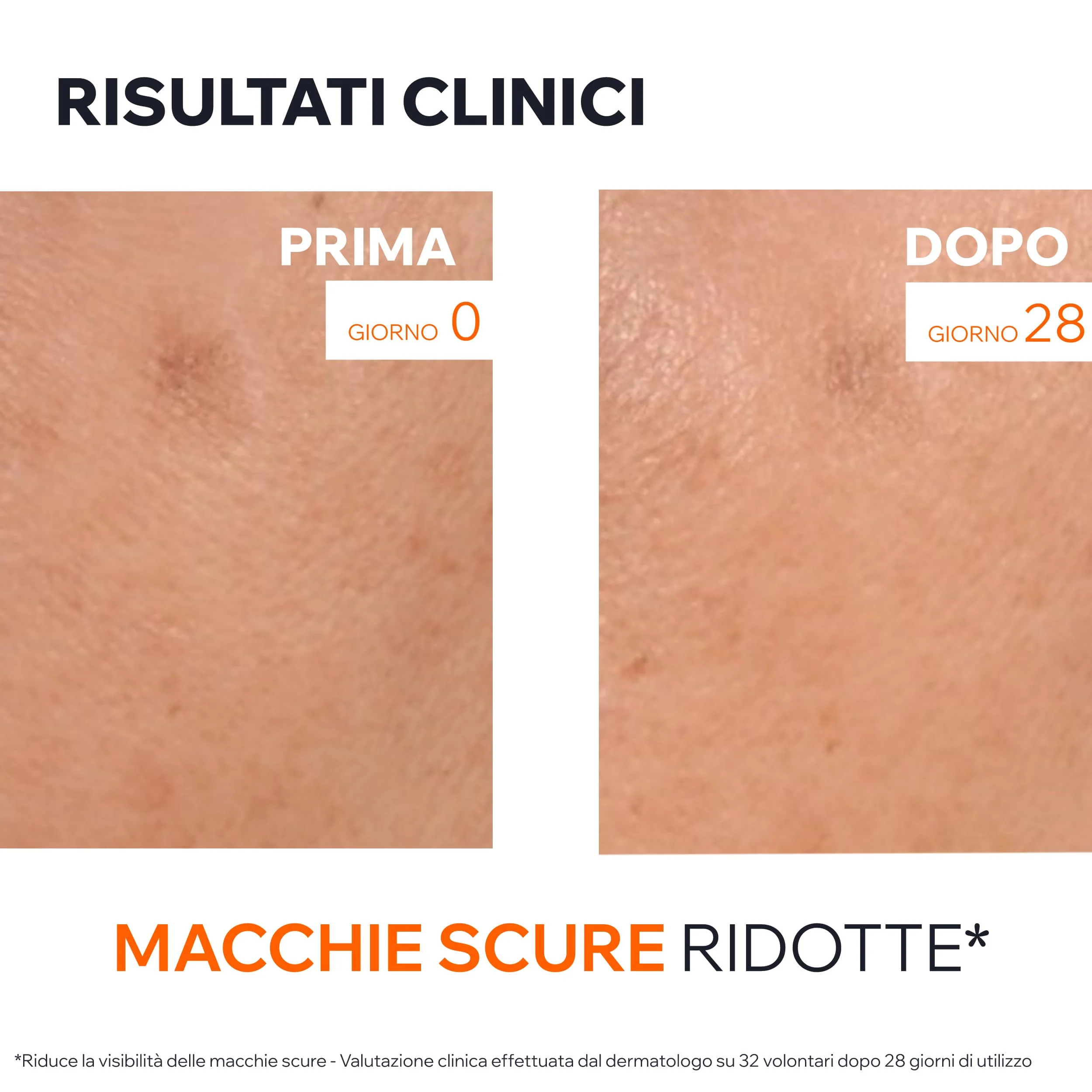 Uriage Depiderm Siero Booster Illuminante 30 ml Anti-Macchie
