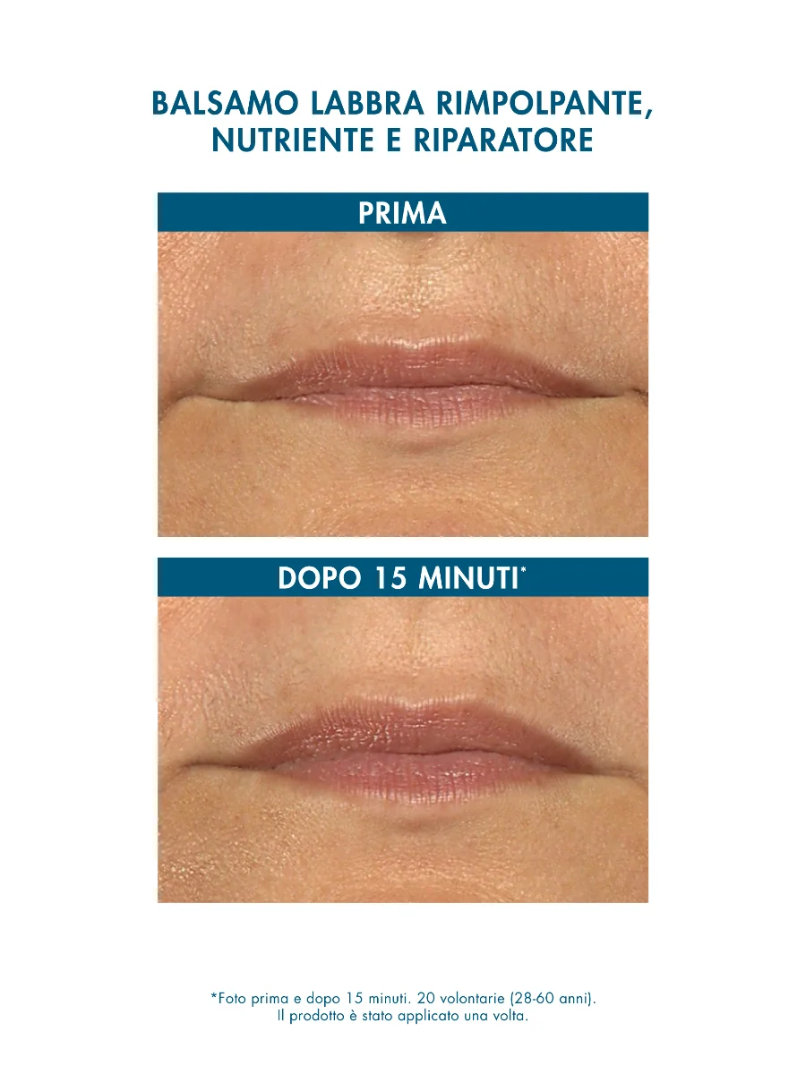 Miamo Longevity Plus Hyalu Repair Lip Balm Frutti Tropicali 15 Ml per Labbra Secche e Screpolate