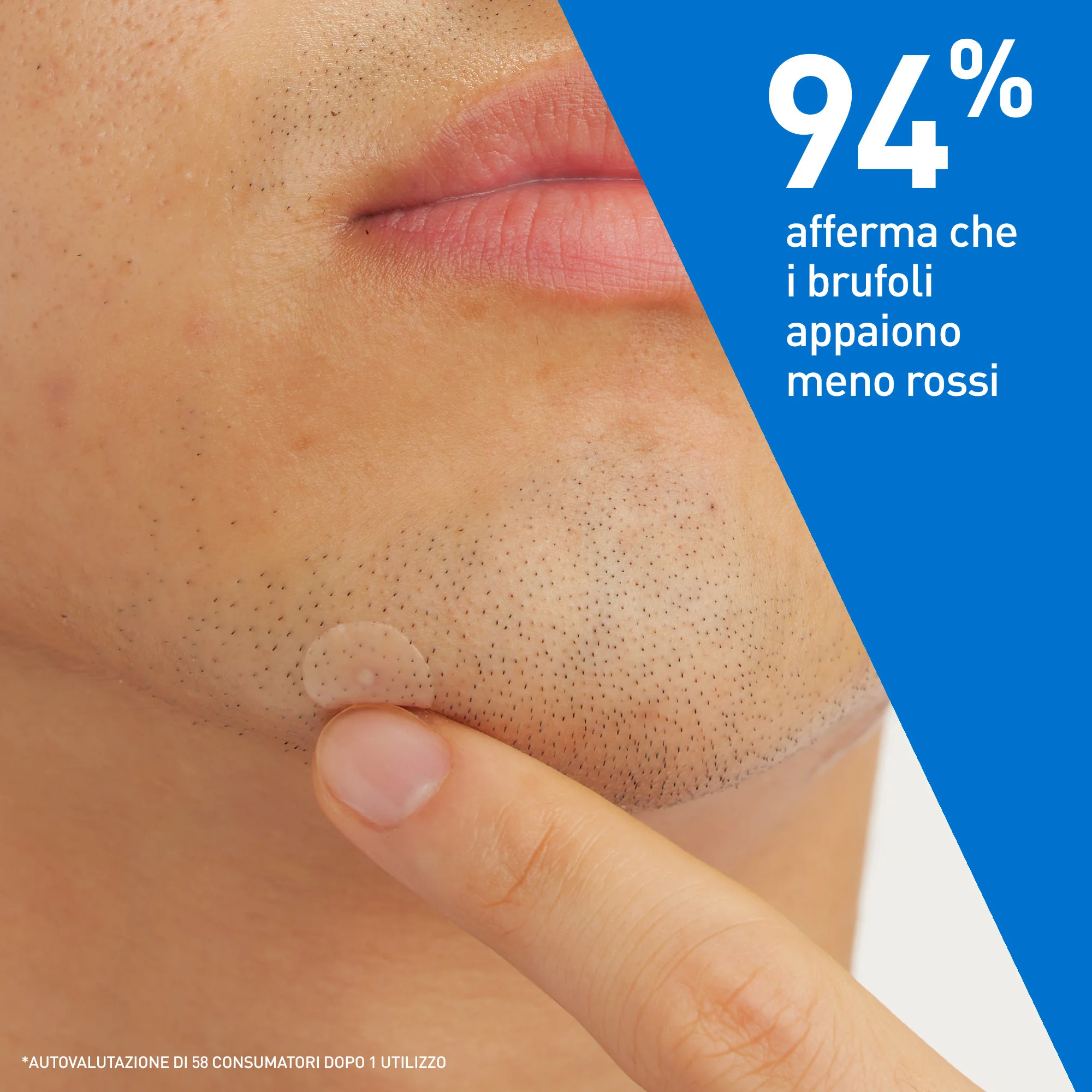 Cerave Patches per il Controllo delle Imperfezioni 22 Pezzi Trattamento Brufoli