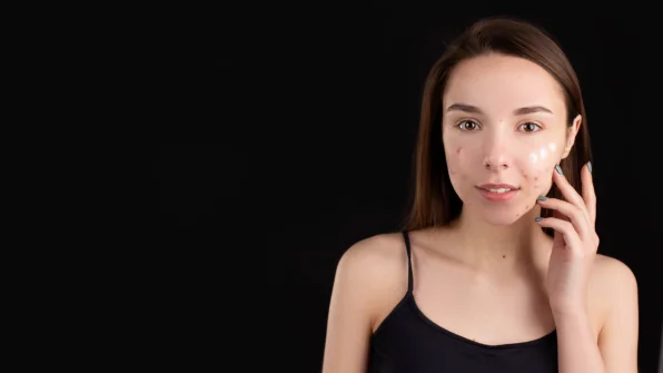 Macchie della pelle: come prevenirle e nasconderle con il make-up correttivo