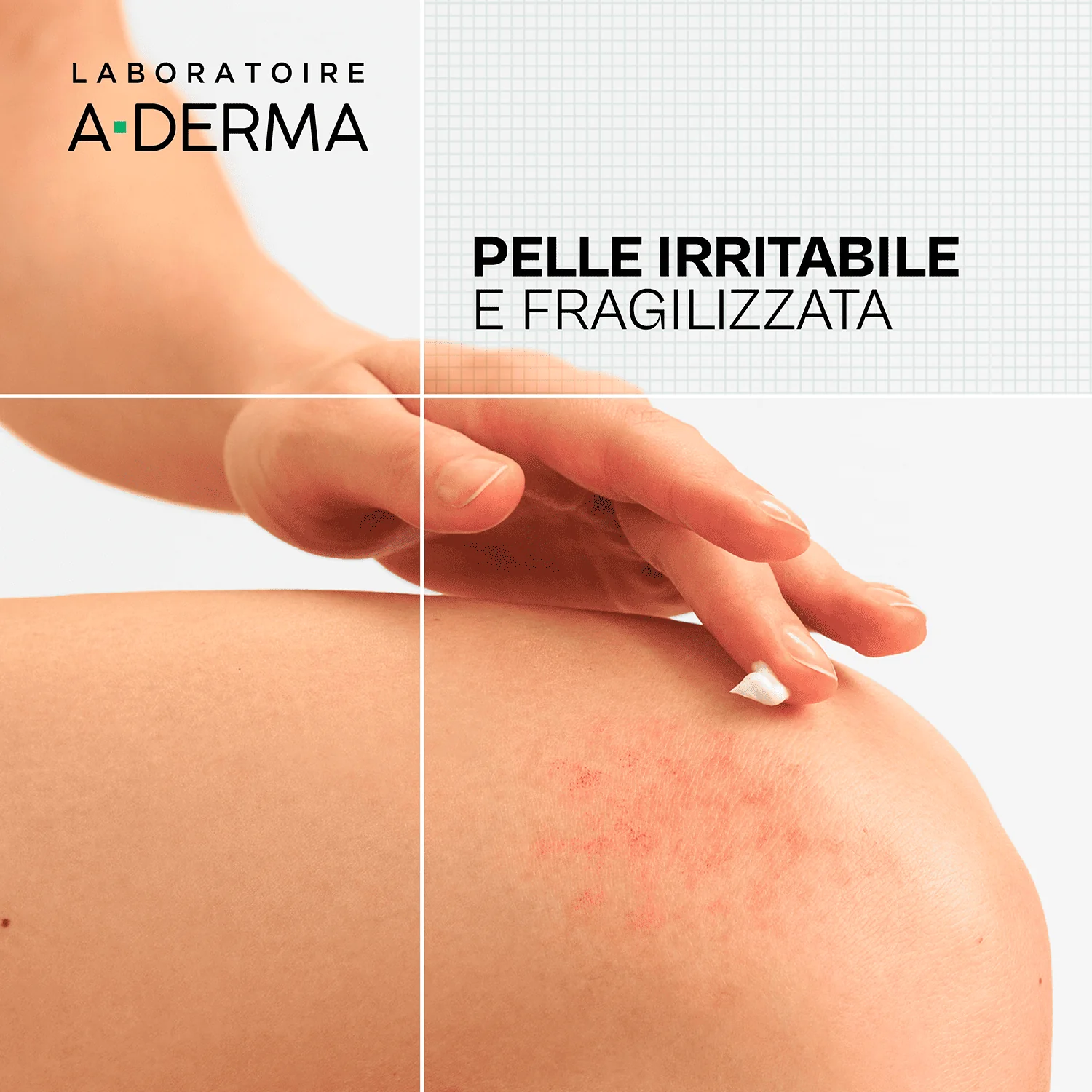 A-Derma Dermalibour+ Crema Riparatrice Pelle Irritata 50 ml