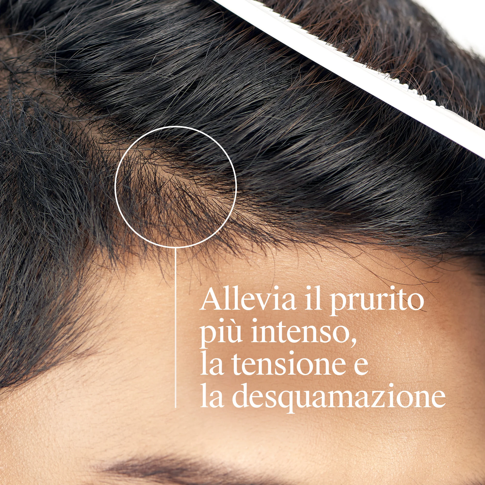 Neutrogena Shampoo Antiforfora T/Gel Forte Prurito Intenso 150 ml Shampoo uomo per forfora secca
