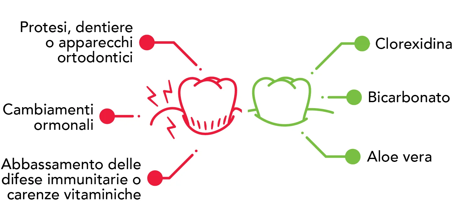 rimedi per gengive infiammate rimedi per gengive infiammate