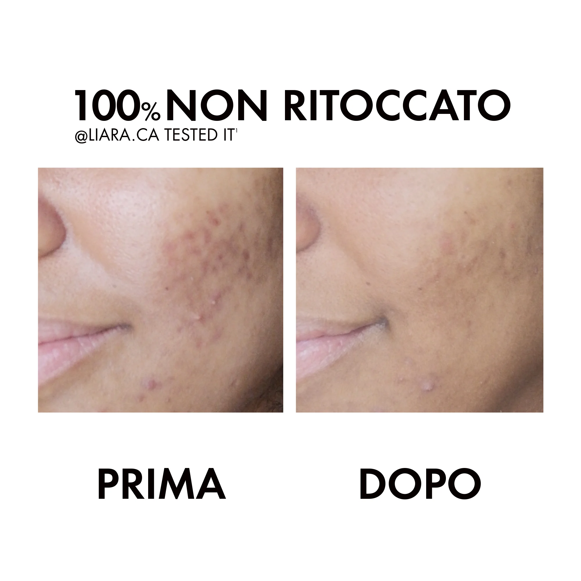 Vichy Normaderm Phytosolution Trattamento Anti-Imperfezioni 50 ml Trattamento idratante con doppia azione