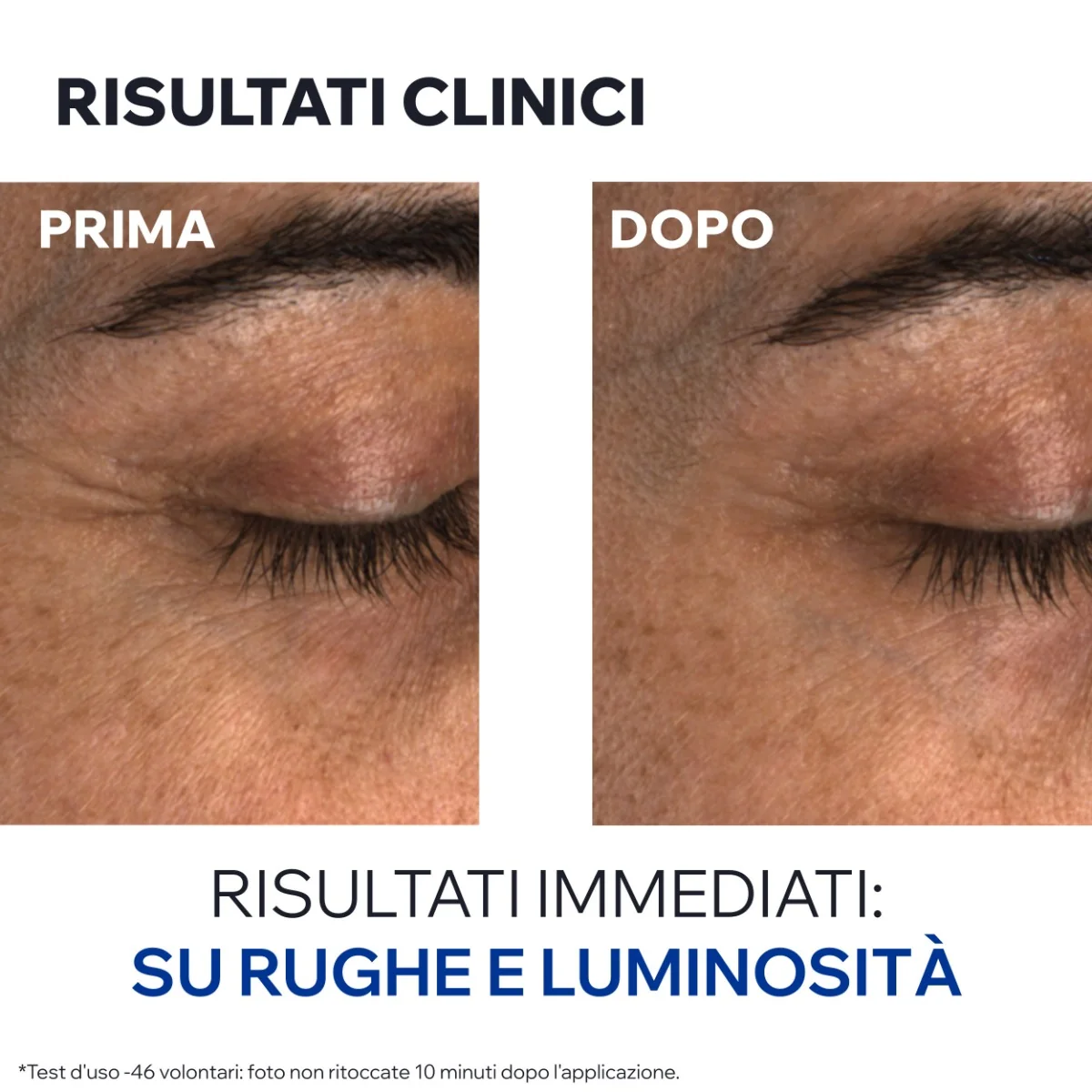 Age Absolu Balsamo Occhi Perfezionatore Ridensificante 15 Ml Dermatologicamente Testato