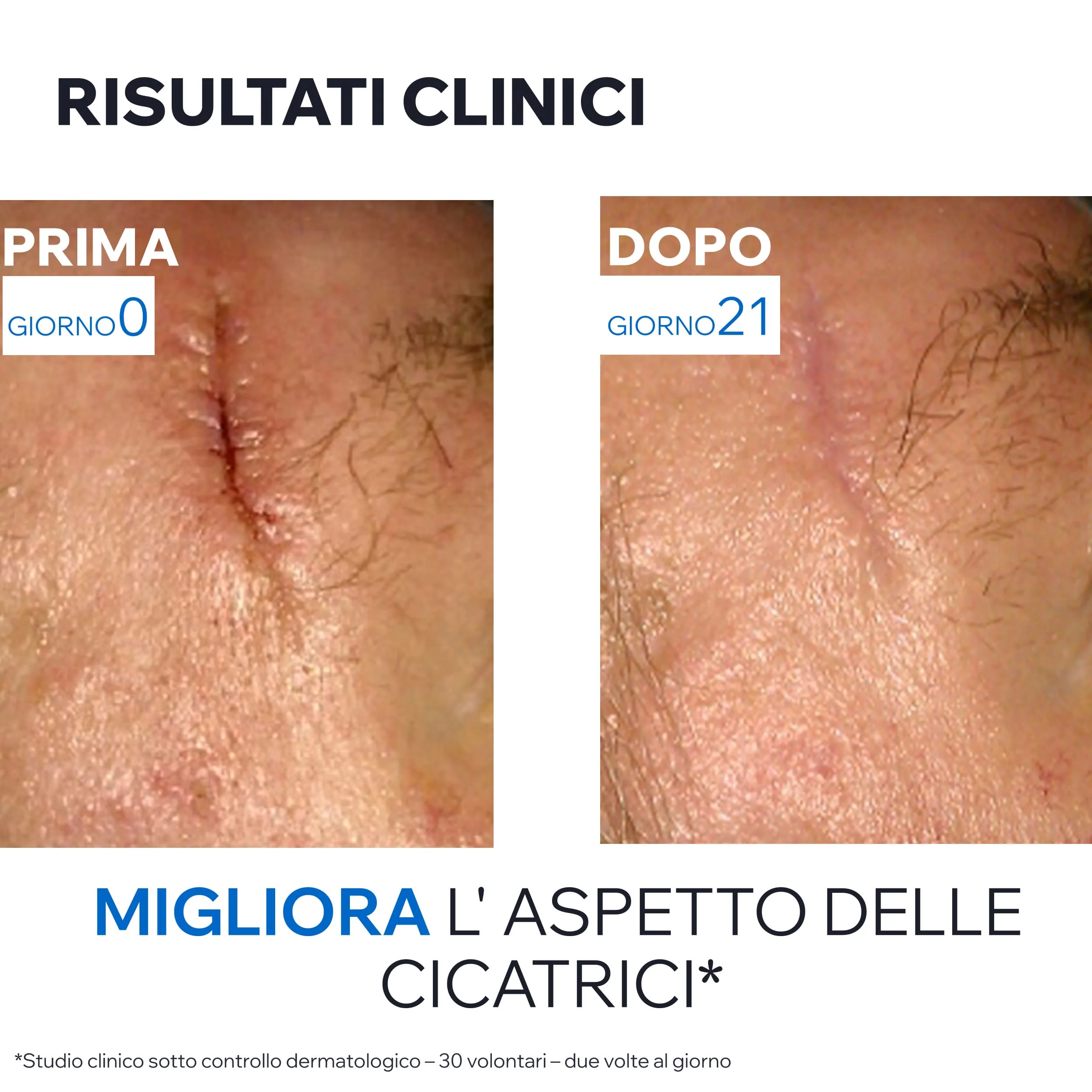 Uriage Barièderm Cica-Crema Riparatrice al Cu-Zn 40 ml Pelle Sensibile e Irritata