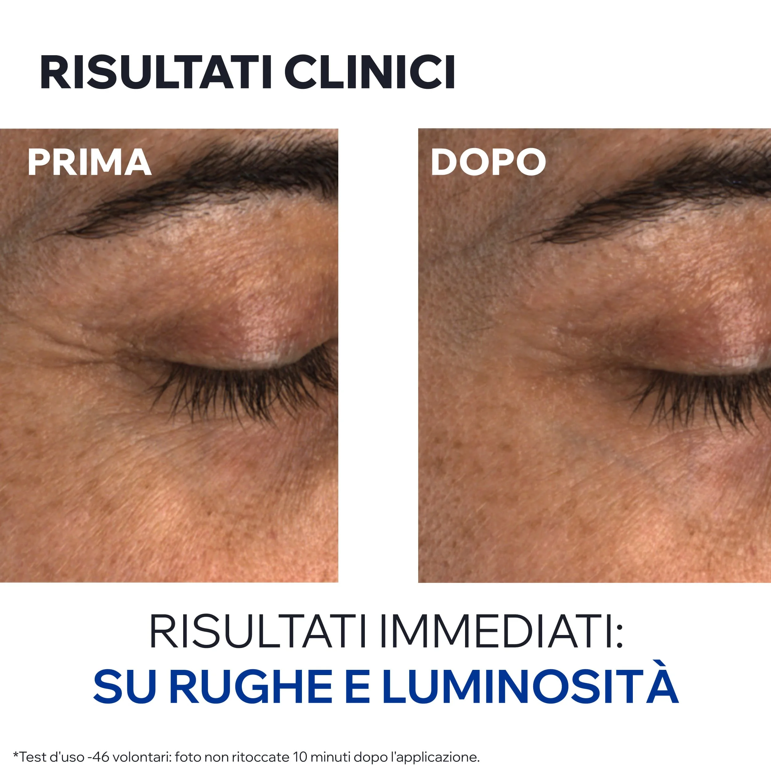Age Absolu Balsamo Occhi Perfezionatore Ridensificante 15 Ml Dermatologicamente Testato