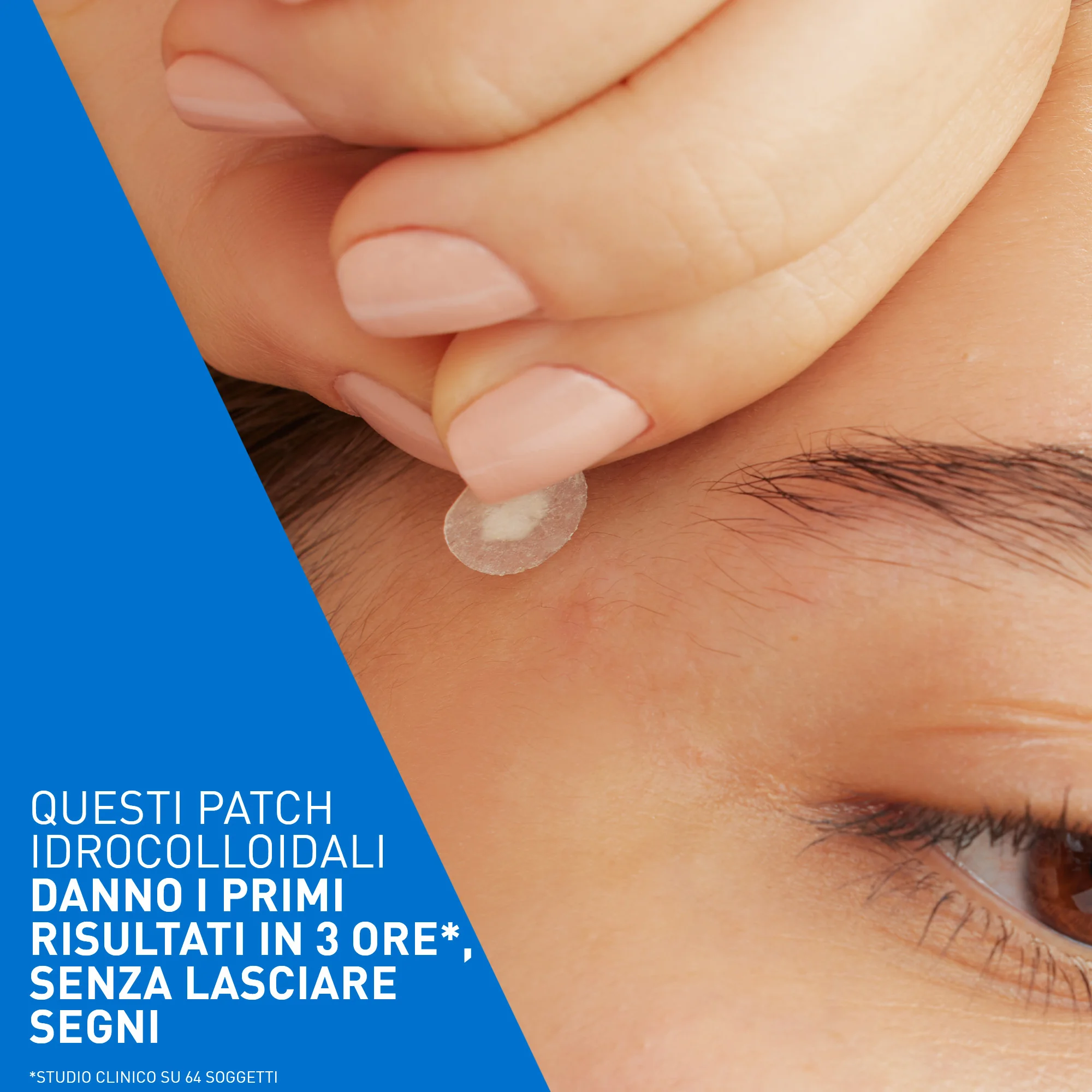 Cerave Patches per il Controllo delle Imperfezioni 22 Pezzi Trattamento Brufoli