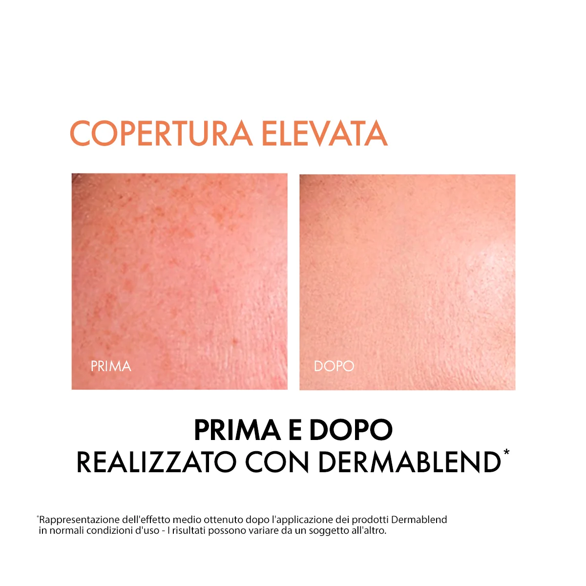 Vichy Dermablend Fluido 15, 30 Ml Fondotinta correttore 16h