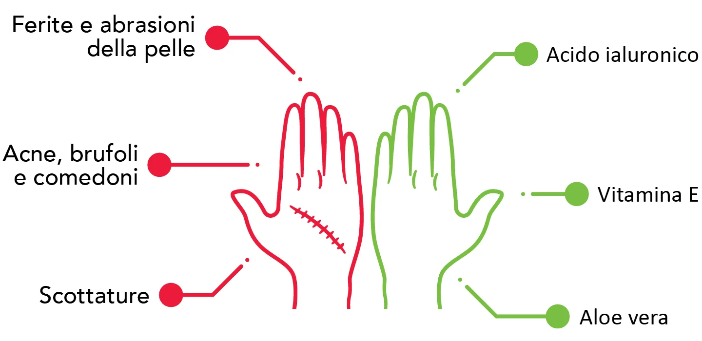 rimedi per cicatrici rimedi per cicatrici