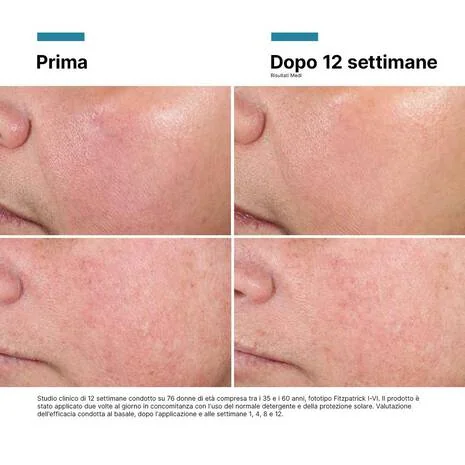 Skinceuticals Advanced Regen 6 50 Ml Invecchiamento Cutaneo
