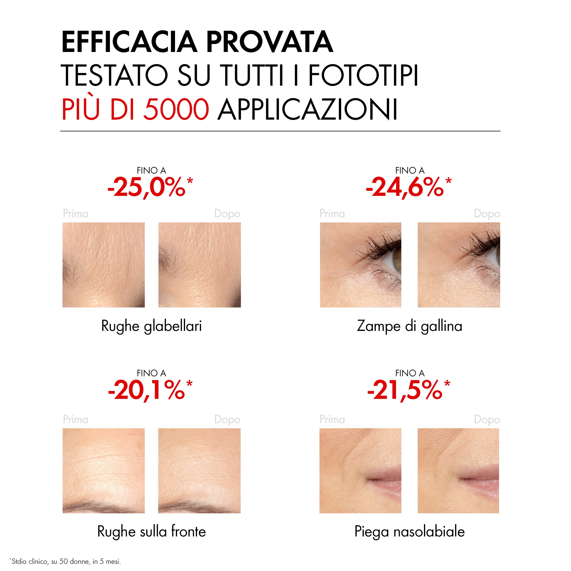 Vichy Liftactiv Specialist Retinol Serum 30 Ml Ridensificante, Anti-età
