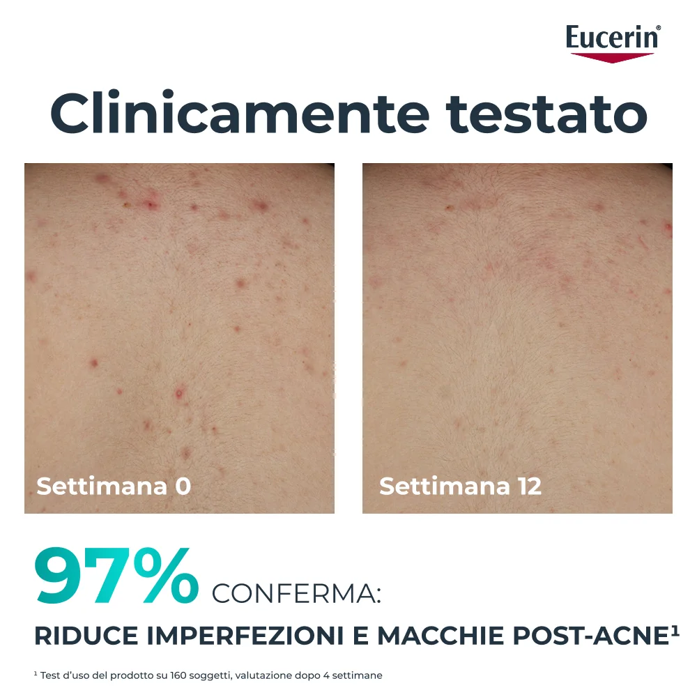 Dermopure Clinical Crema Corpo Tripla Azione 200 ml Anti Imperfezioni e Anti Macchie