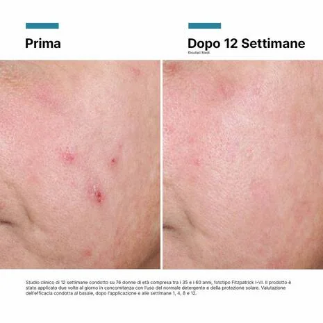 Skinceuticals Advanced Regen 6 50 Ml Invecchiamento Cutaneo