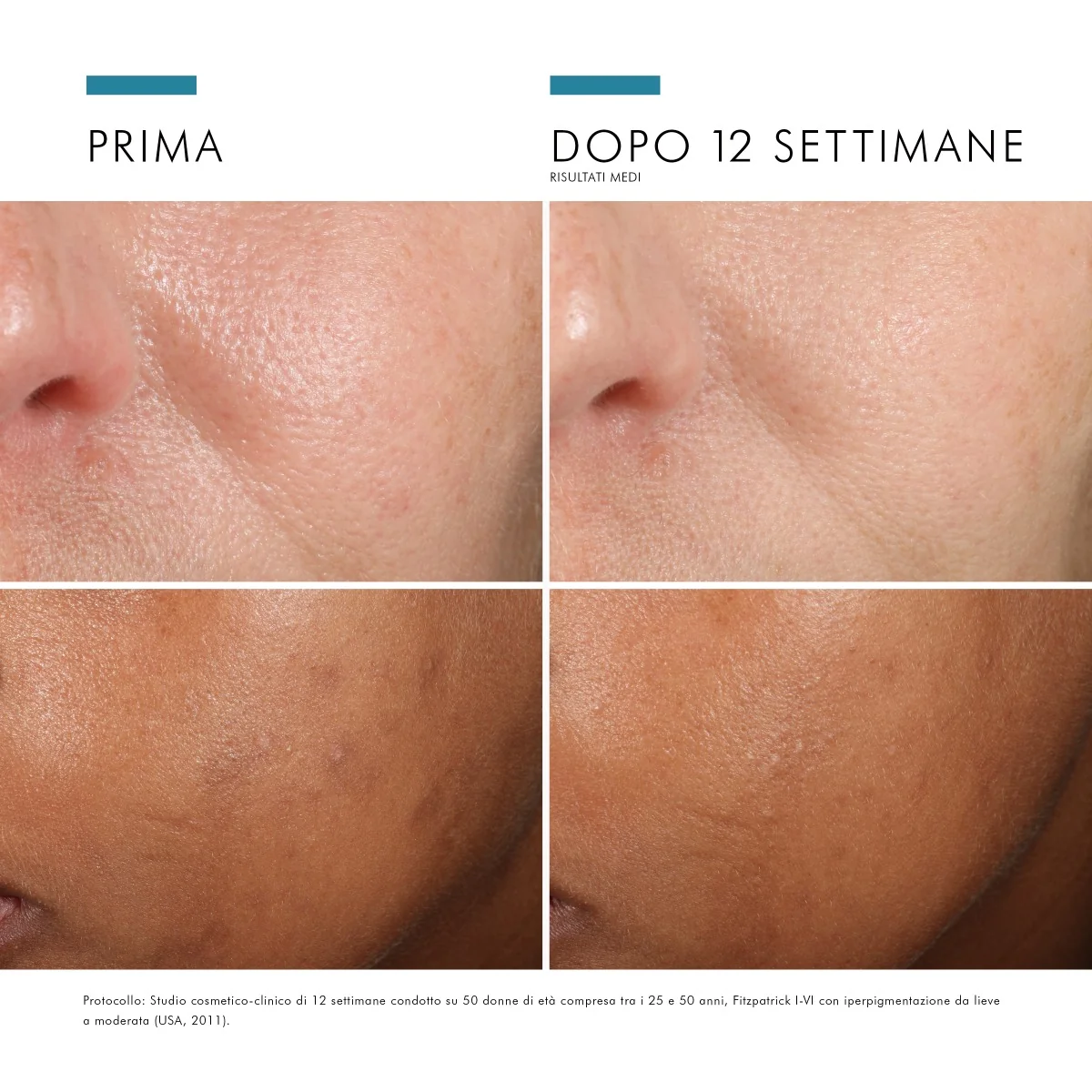 SkinCeuticals Phloretin CF Siero Antiossidante 30 Ml Con 10% di Vitamina C